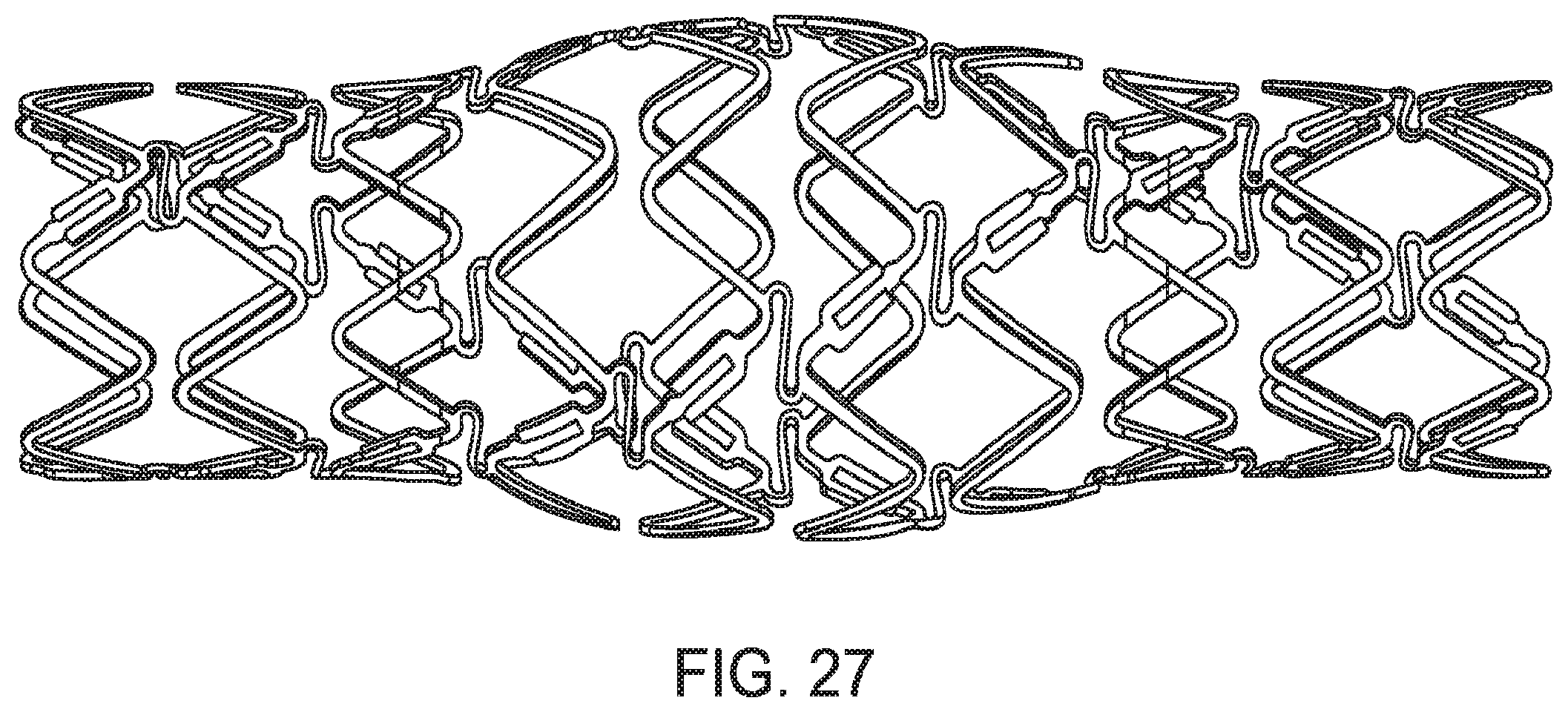 Patent US12599490 Figure 20 – Uncaging stent