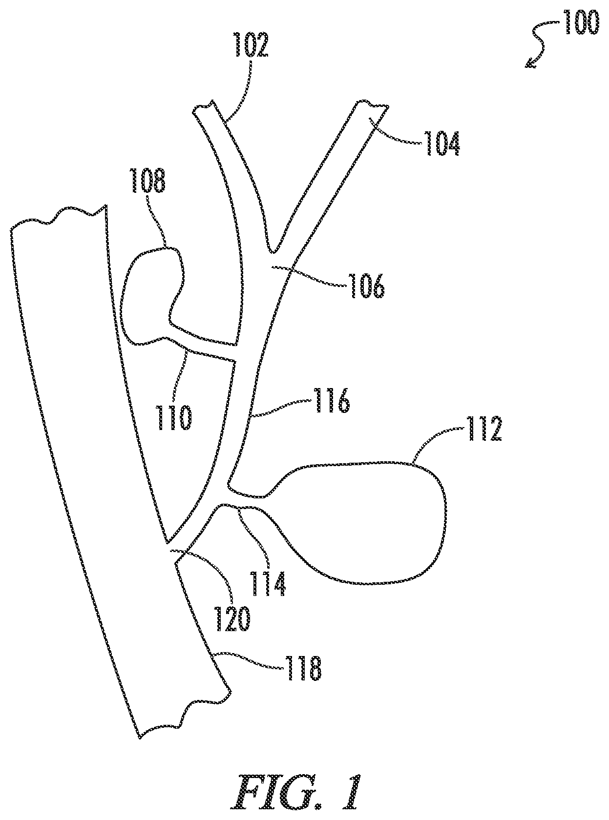 Patent US12599491 Figure 1 – Biliary stent