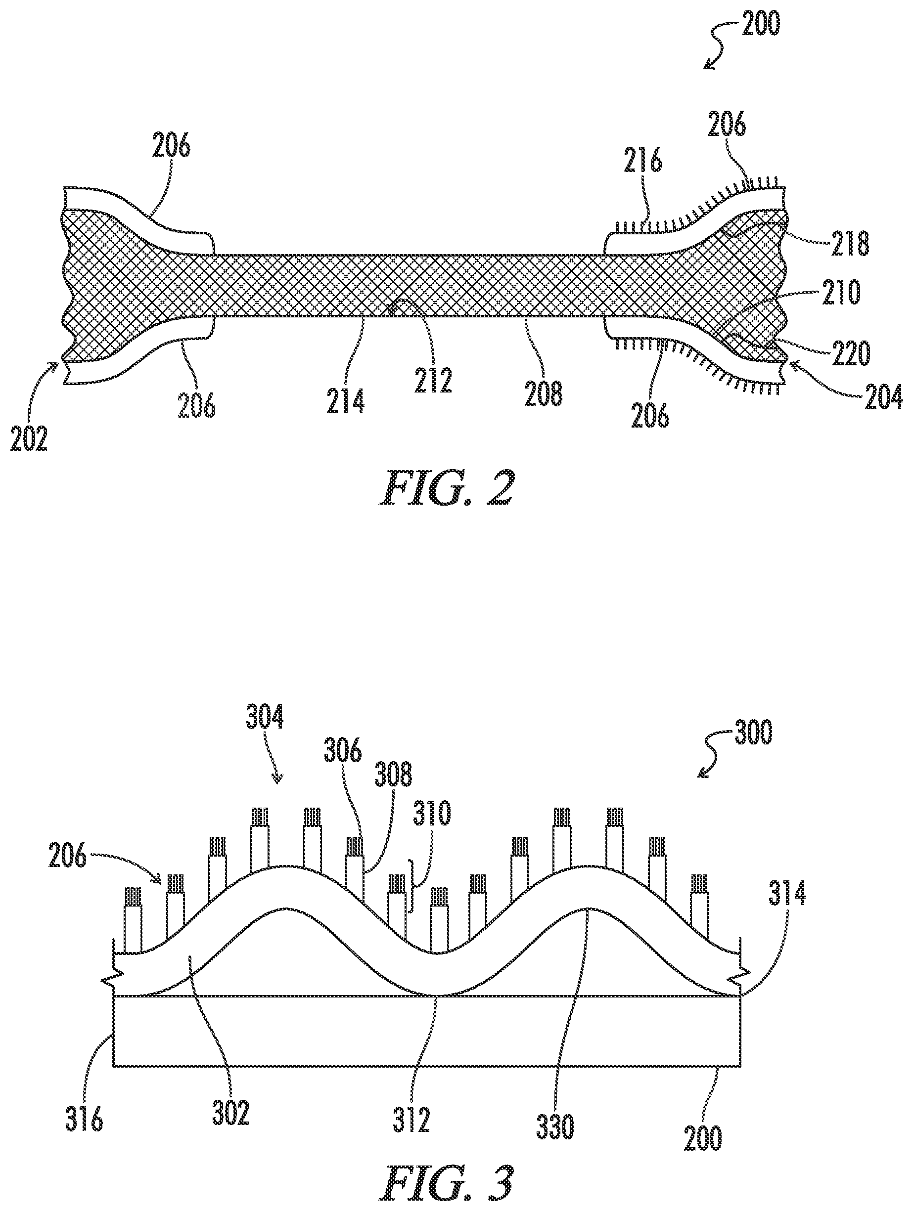 Patent US12599491 Figure 2 – Biliary stent