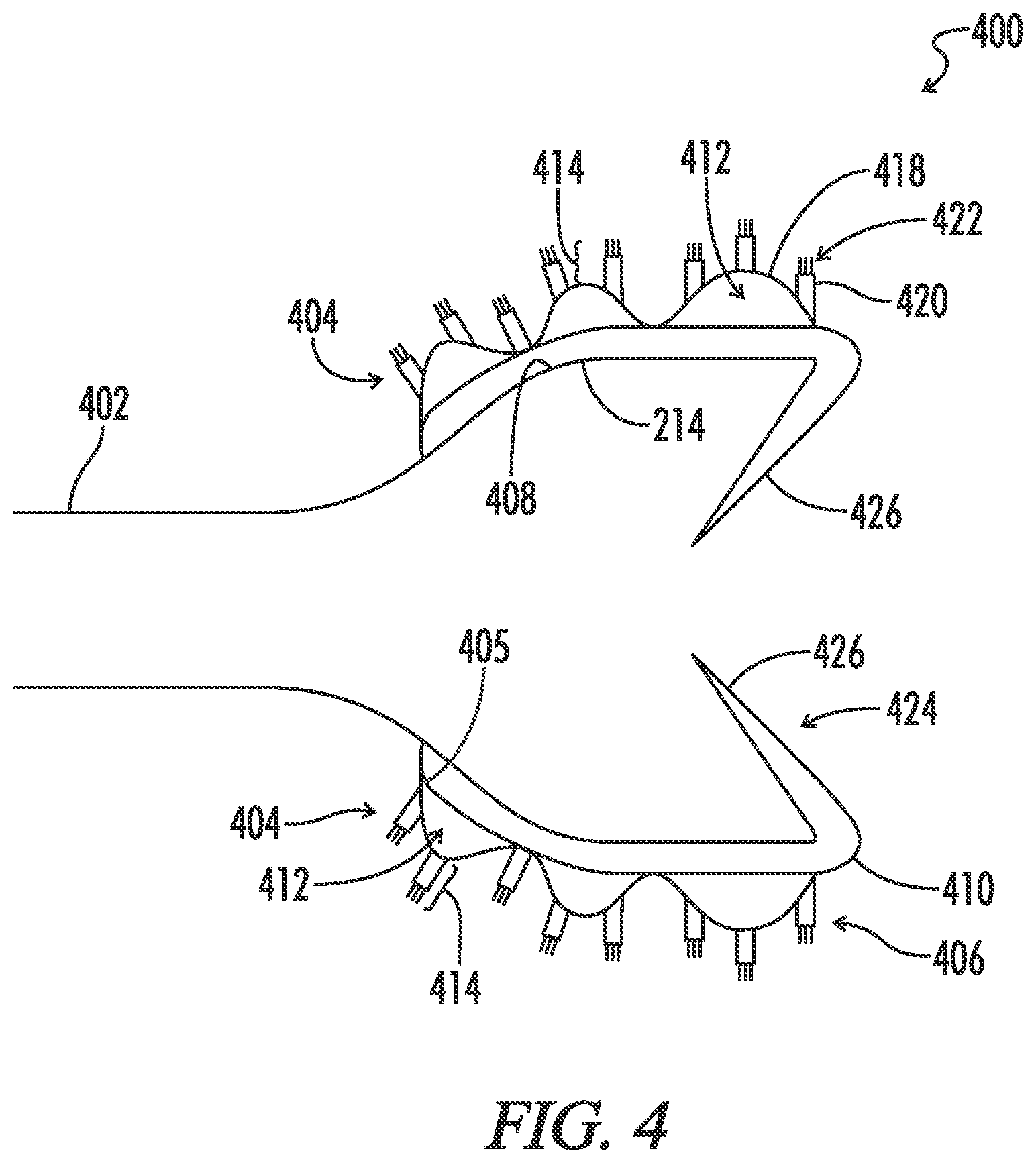 Patent US12599491 Figure 3 – Biliary stent