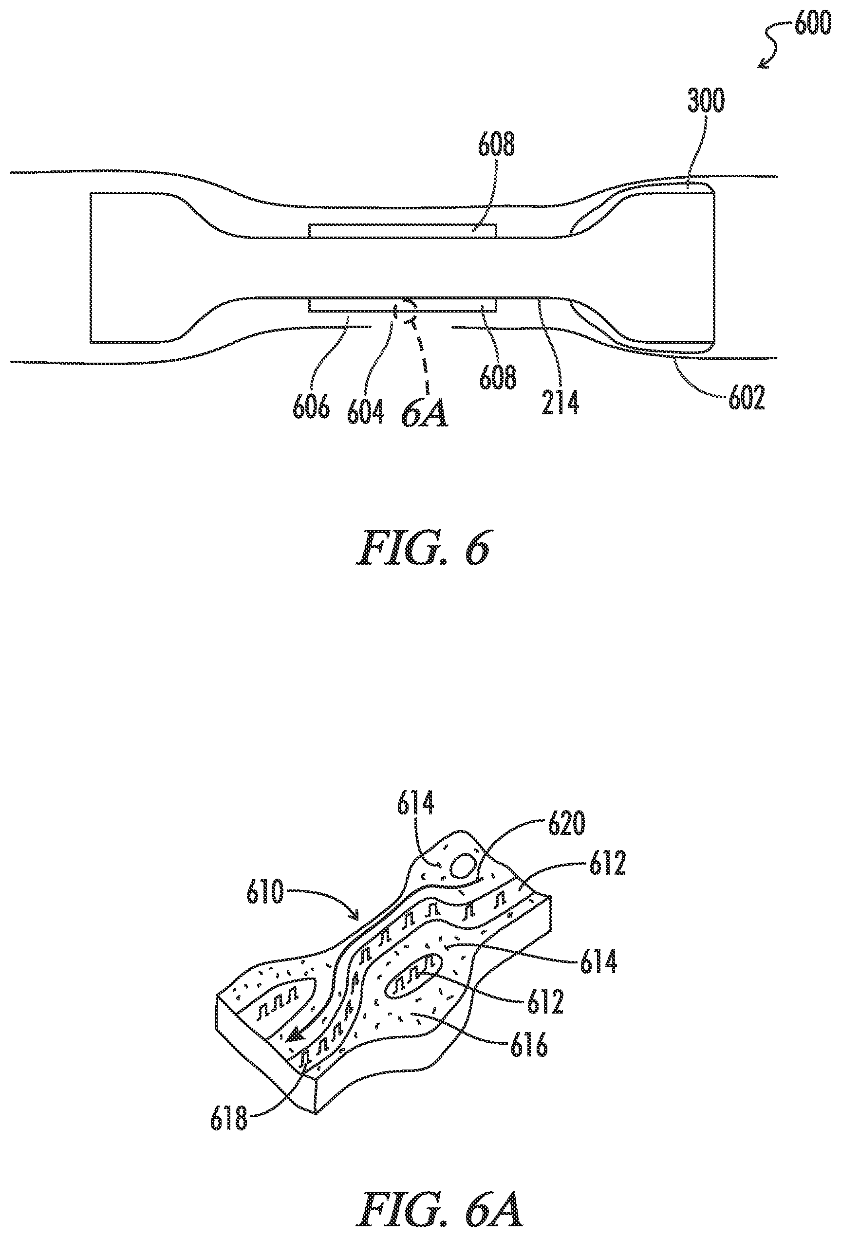 Patent US12599491 Figure 5 – Biliary stent