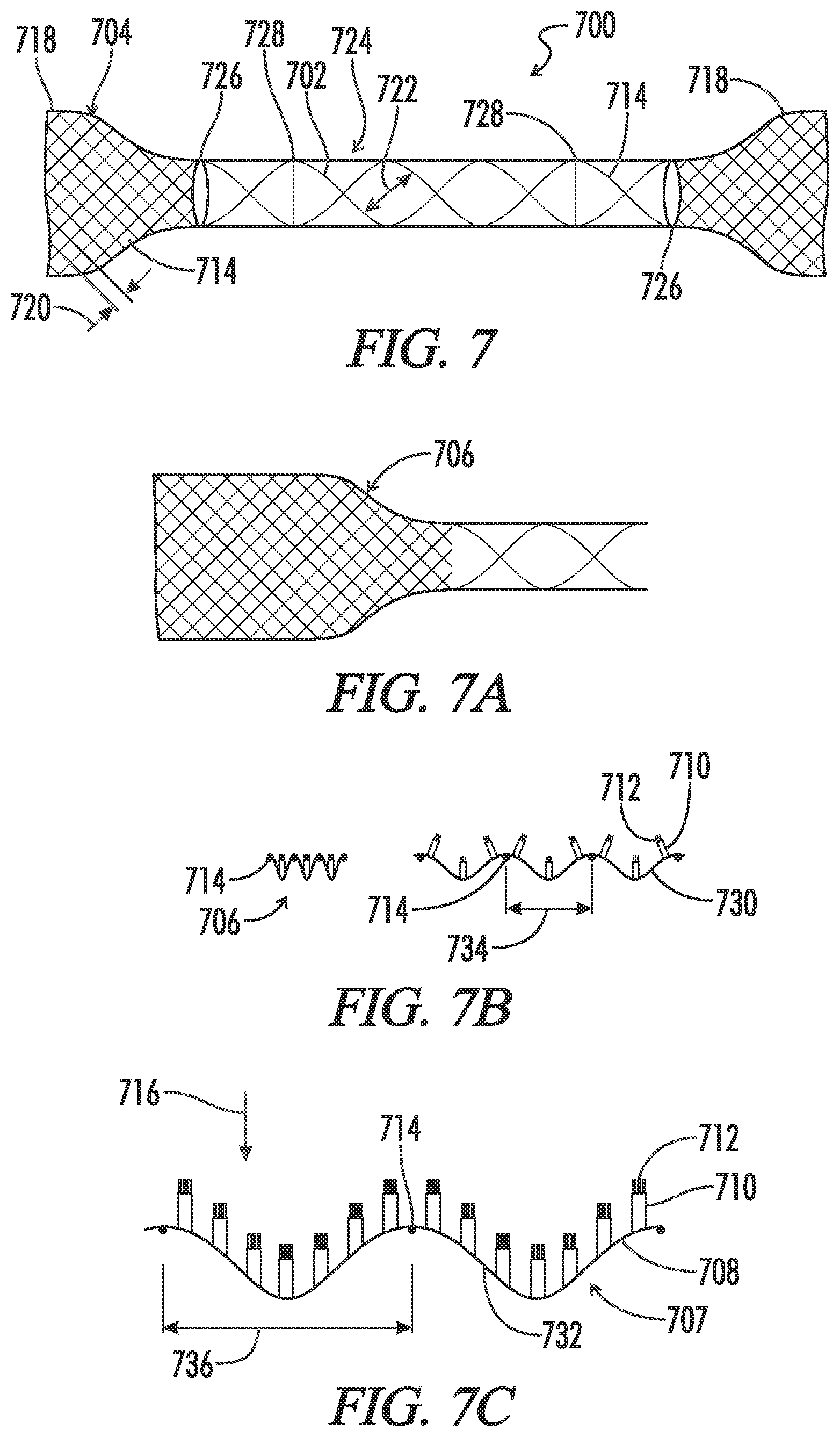 Patent US12599491 Figure 6 – Biliary stent