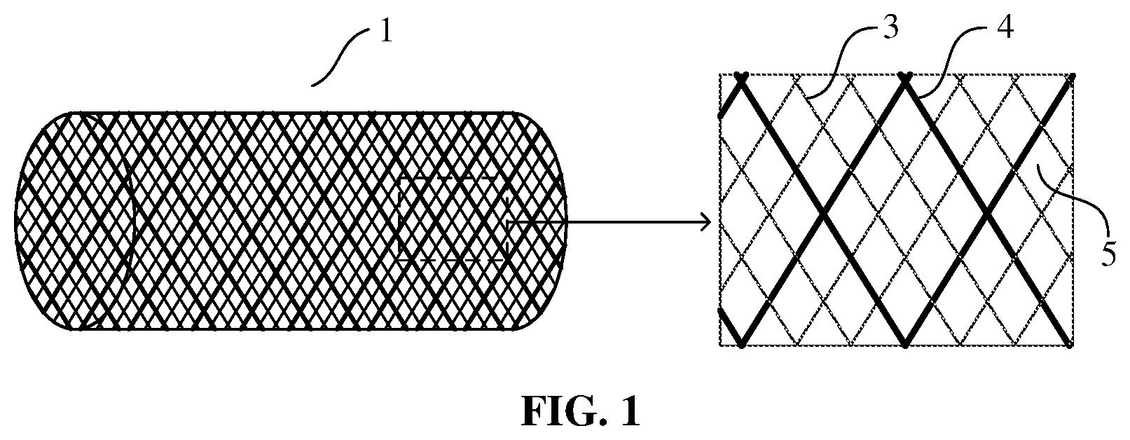 Patent US12599492 Figure 1 – Axially compressible bare stent