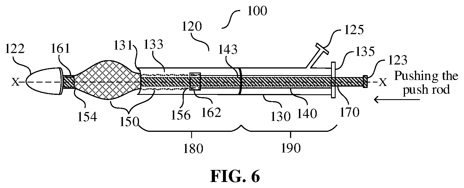 Patent US12599492 Figure 6 – Axially compressible bare stent