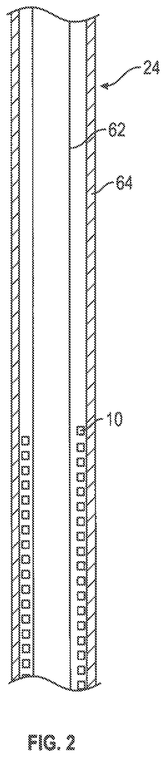 Patent US12599493 Figure 2 – Method of deploying an intraluminal device and intraluminal system
