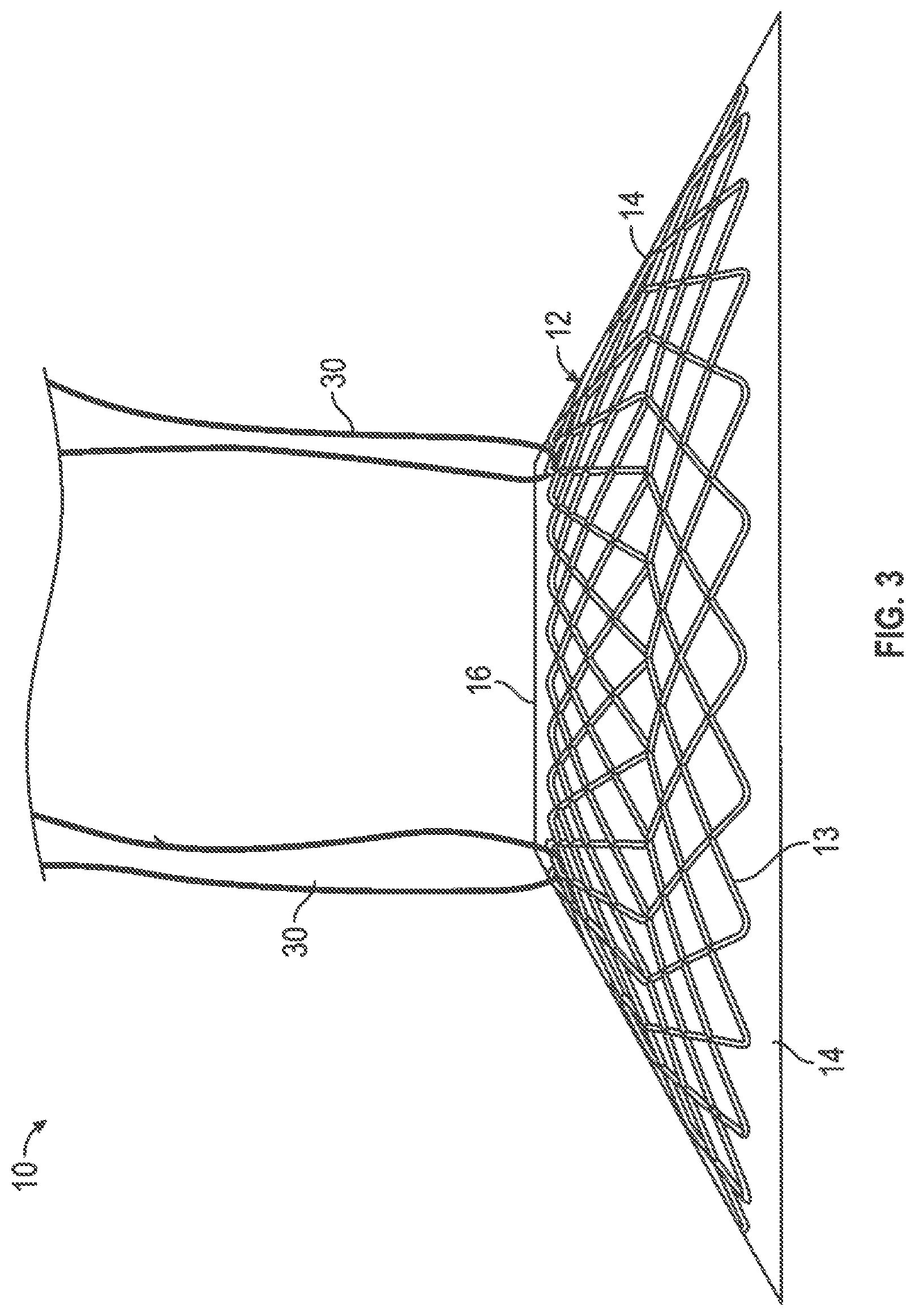 Patent US12599493 Figure 3 – Method of deploying an intraluminal device and intraluminal system