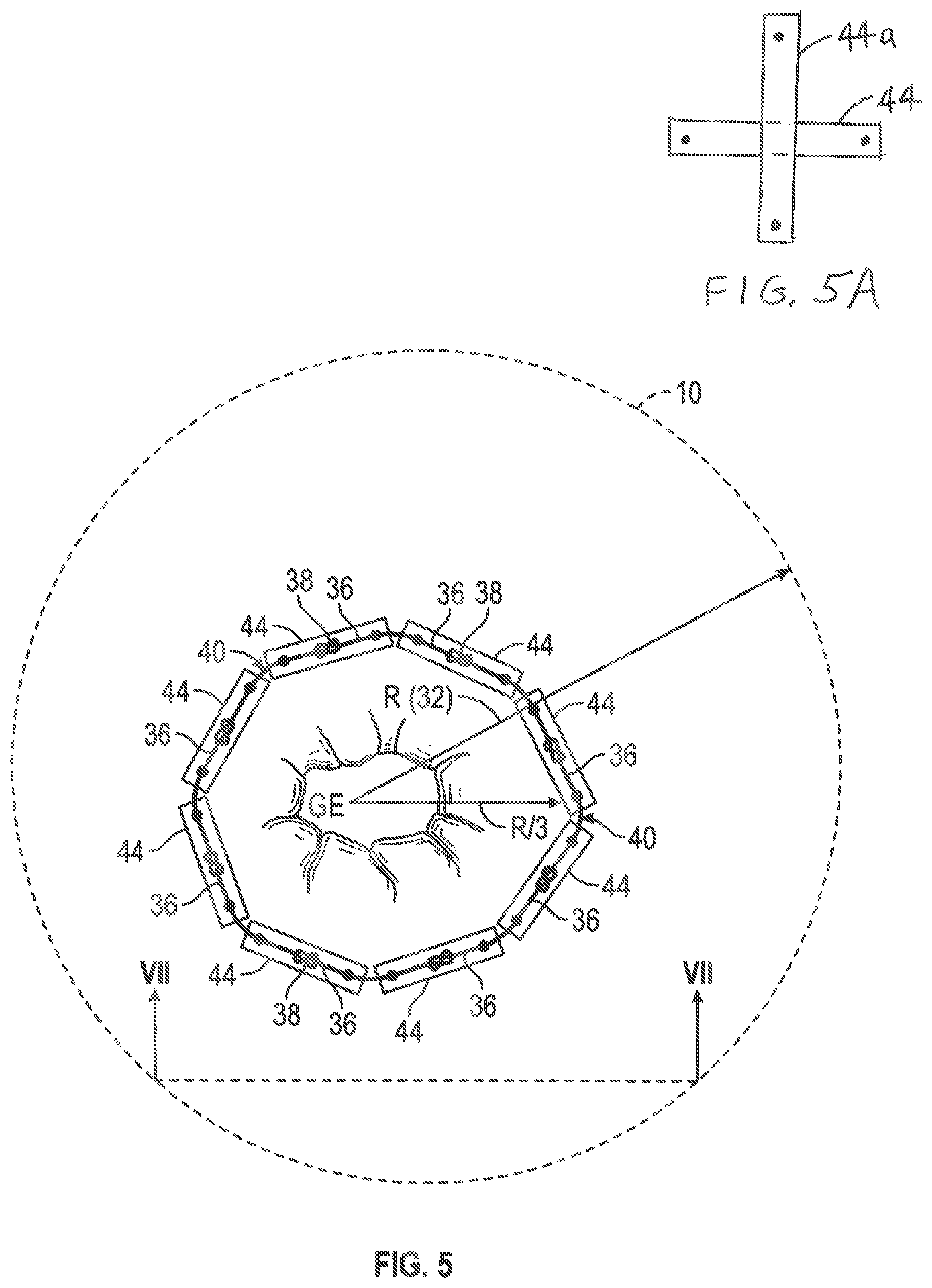 Patent US12599493 Figure 5 – Method of deploying an intraluminal device and intraluminal system