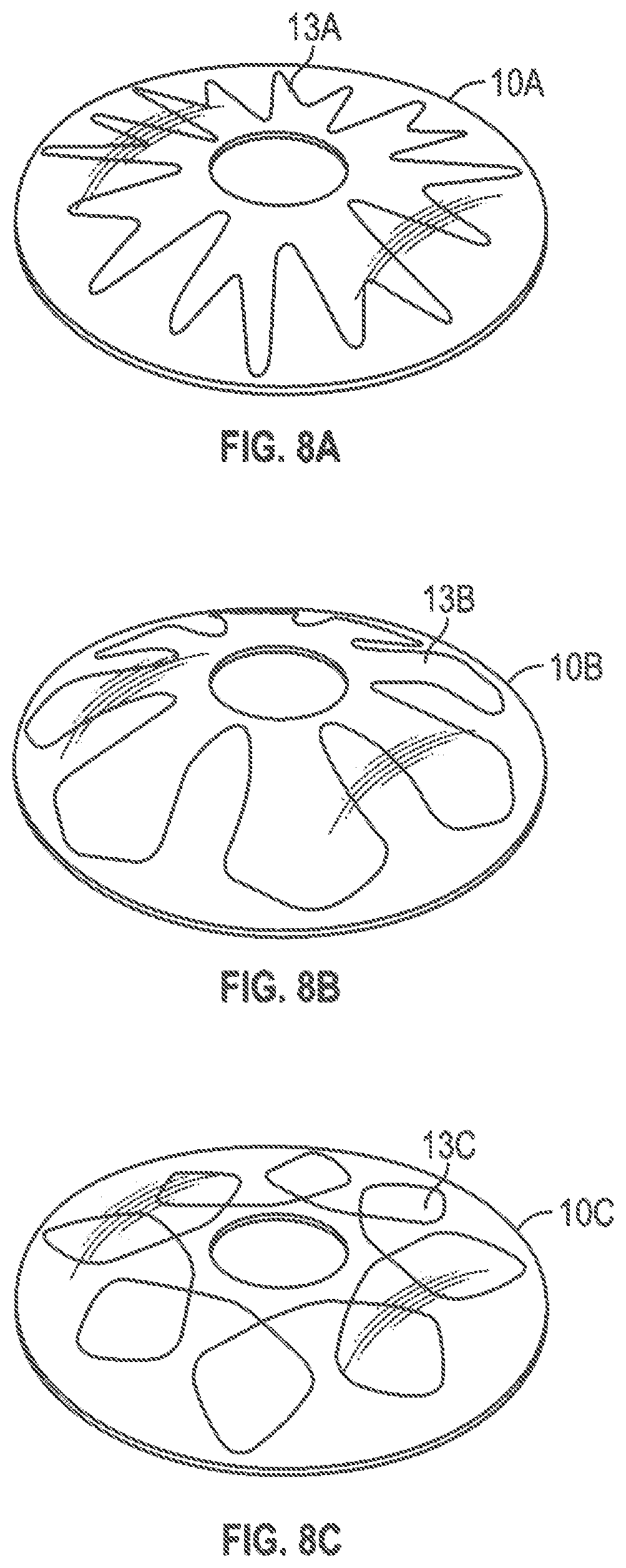 Patent US12599493 Figure 8 – Method of deploying an intraluminal device and intraluminal system