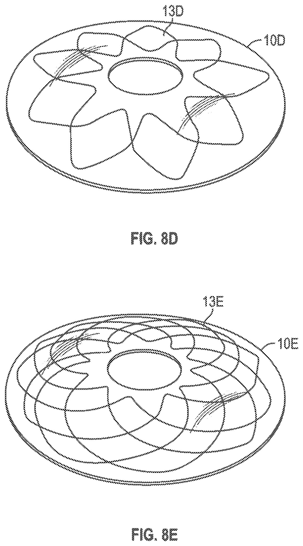 Patent US12599493 Figure 9 – Method of deploying an intraluminal device and intraluminal system