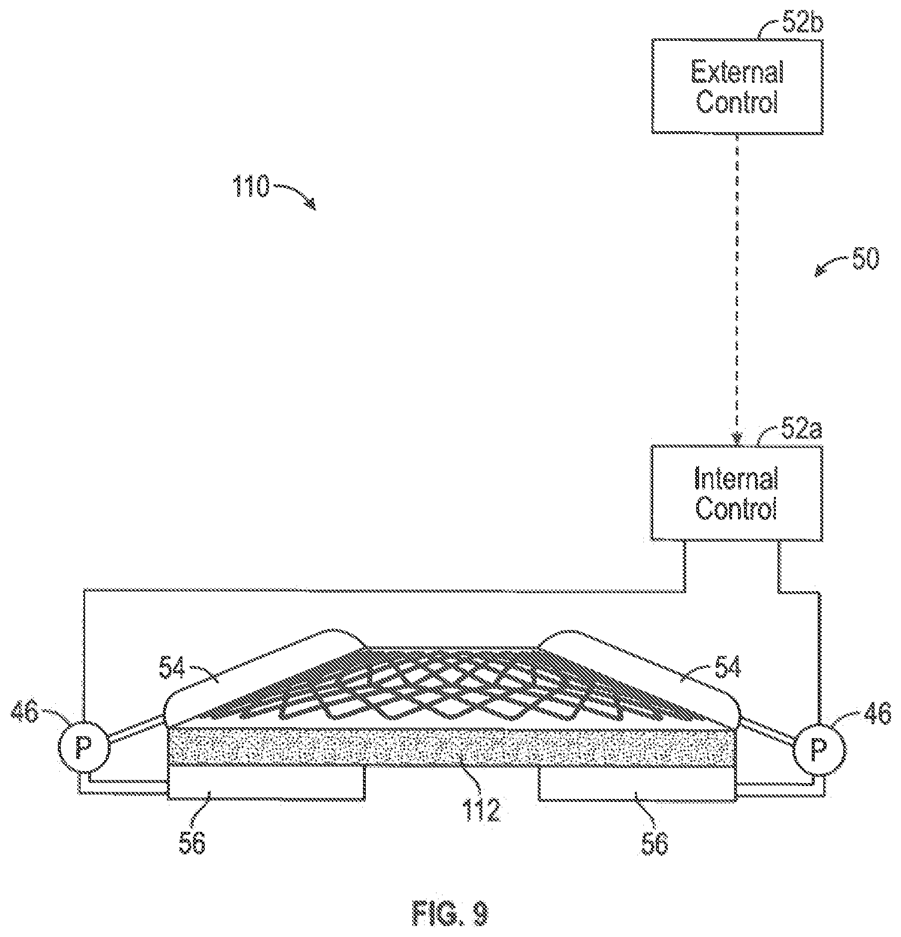 Patent US12599493 Figure 10 – Method of deploying an intraluminal device and intraluminal system