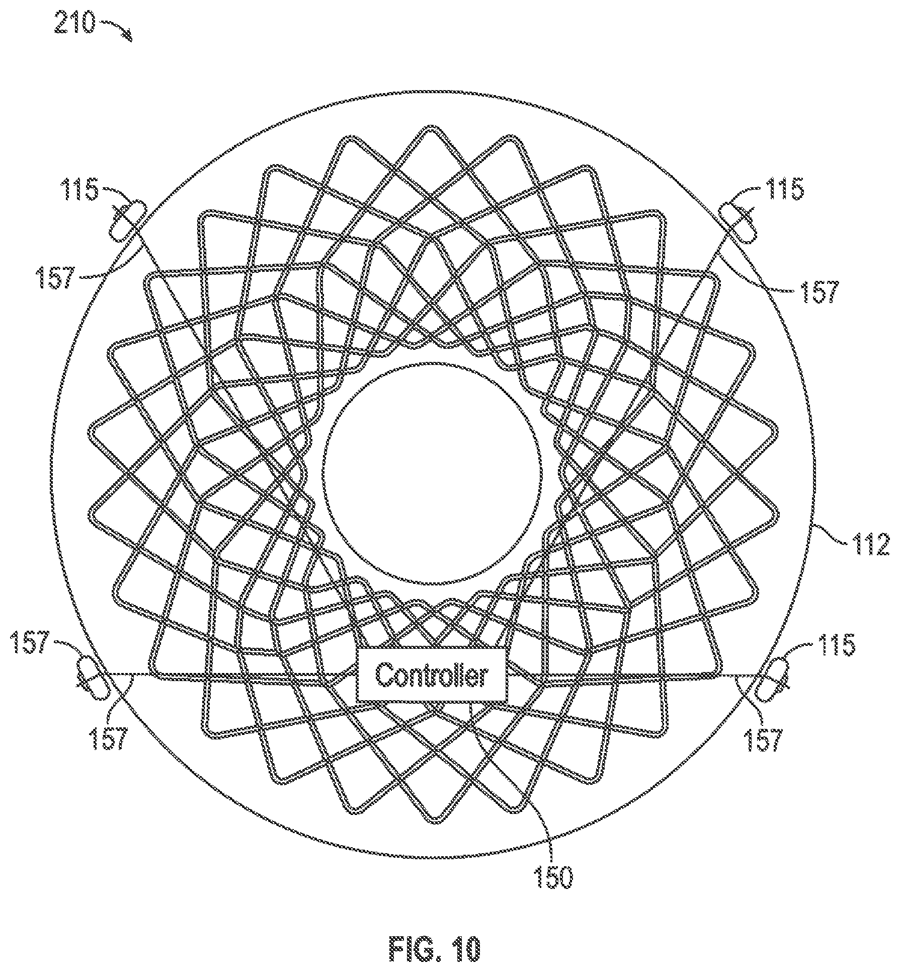 Patent US12599493 Figure 11 – Method of deploying an intraluminal device and intraluminal system