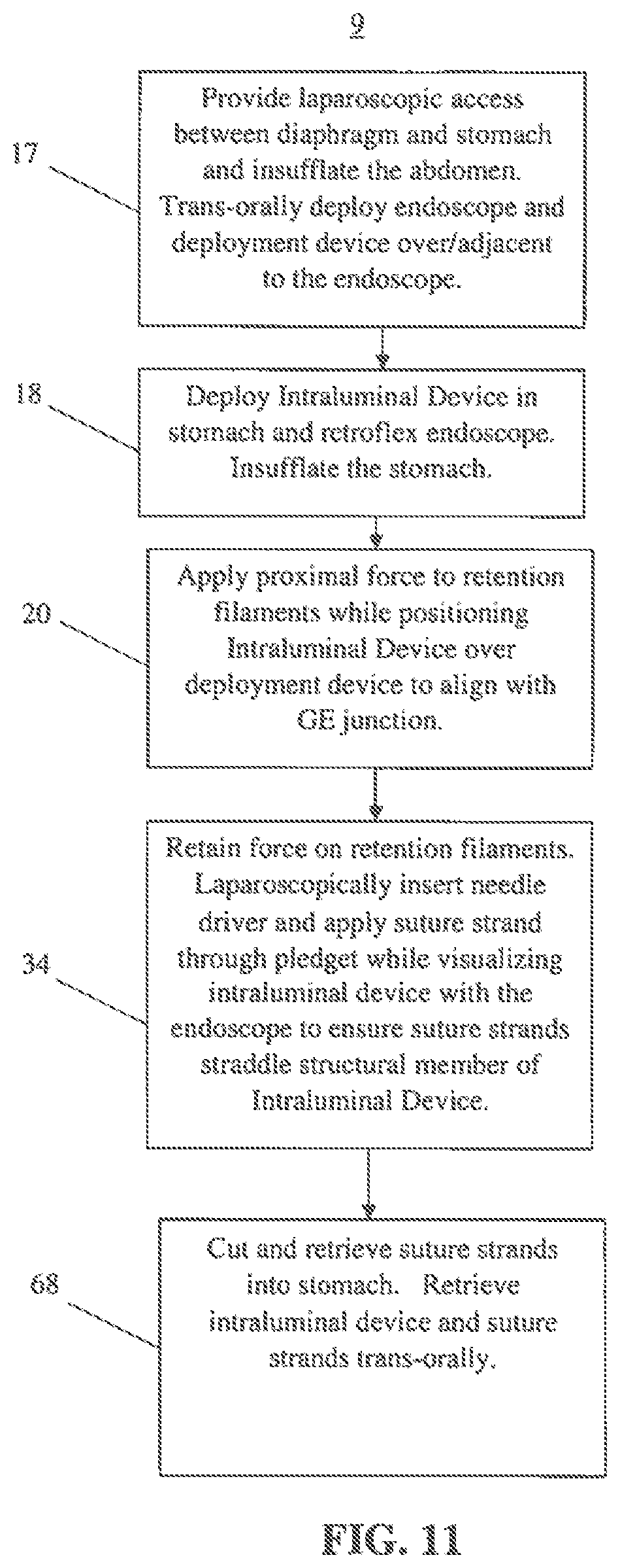 Patent US12599493 Figure 12 – Method of deploying an intraluminal device and intraluminal system