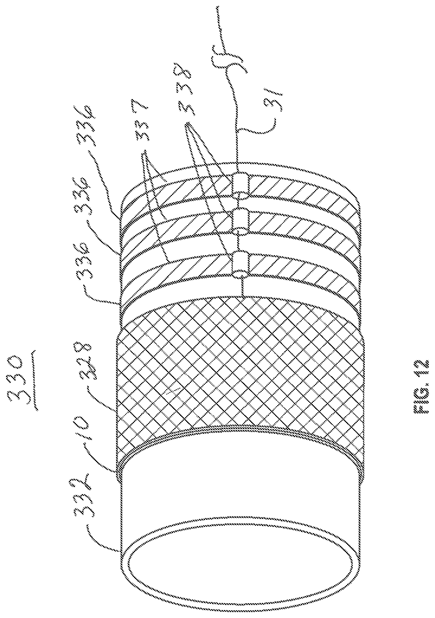 Patent US12599493 Figure 13 – Method of deploying an intraluminal device and intraluminal system