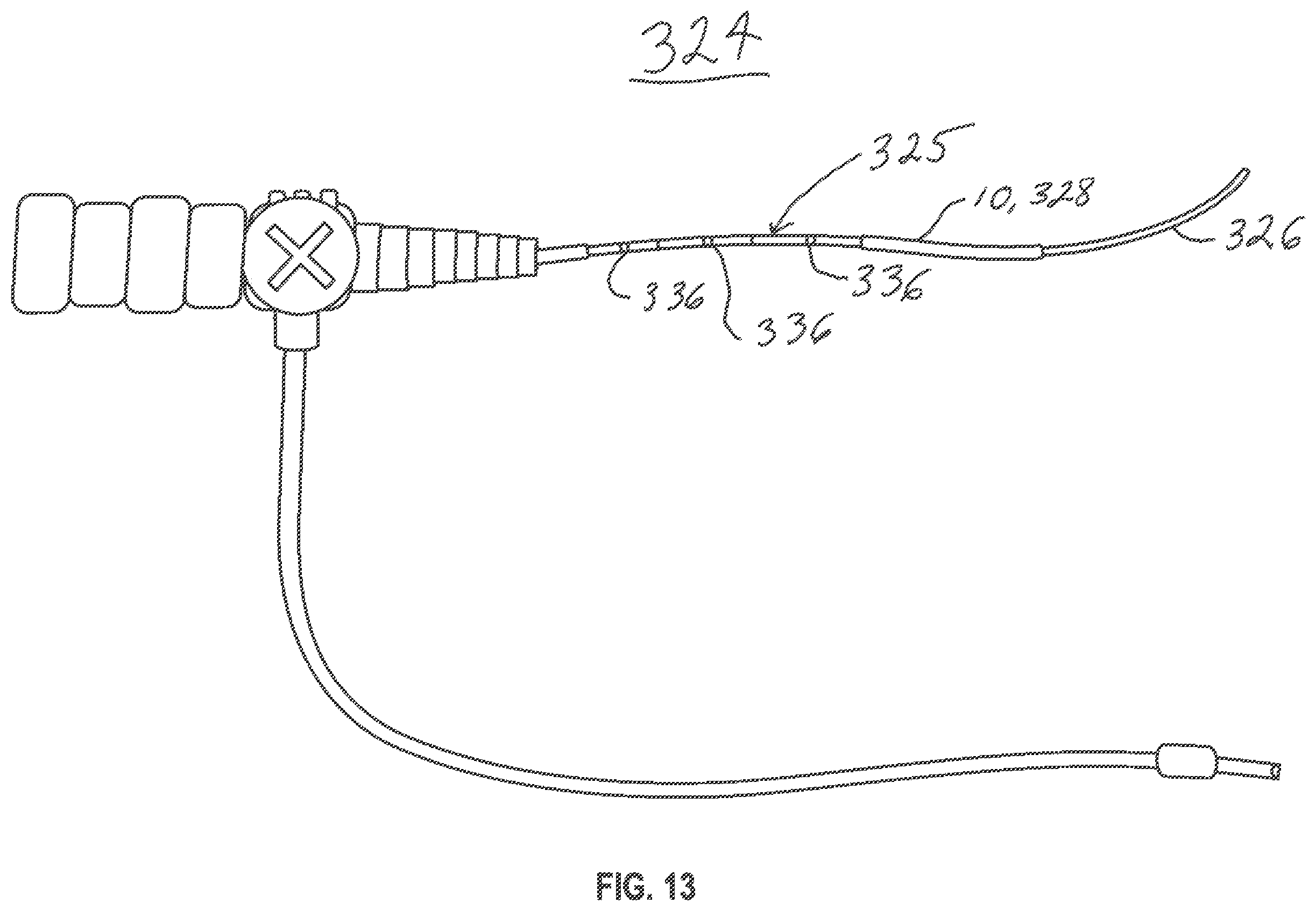 Patent US12599493 Figure 14 – Method of deploying an intraluminal device and intraluminal system
