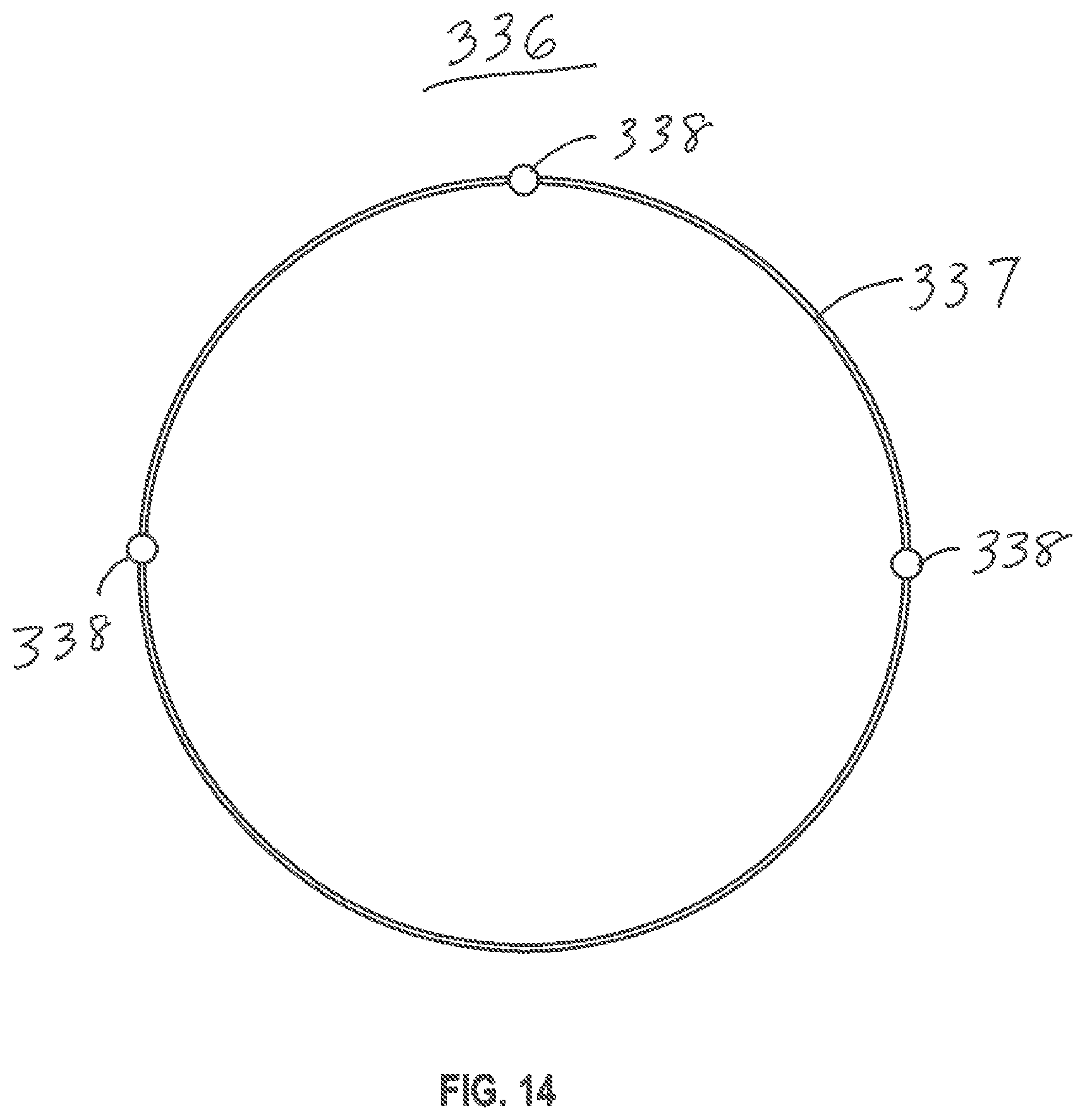 Patent US12599493 Figure 15 – Method of deploying an intraluminal device and intraluminal system