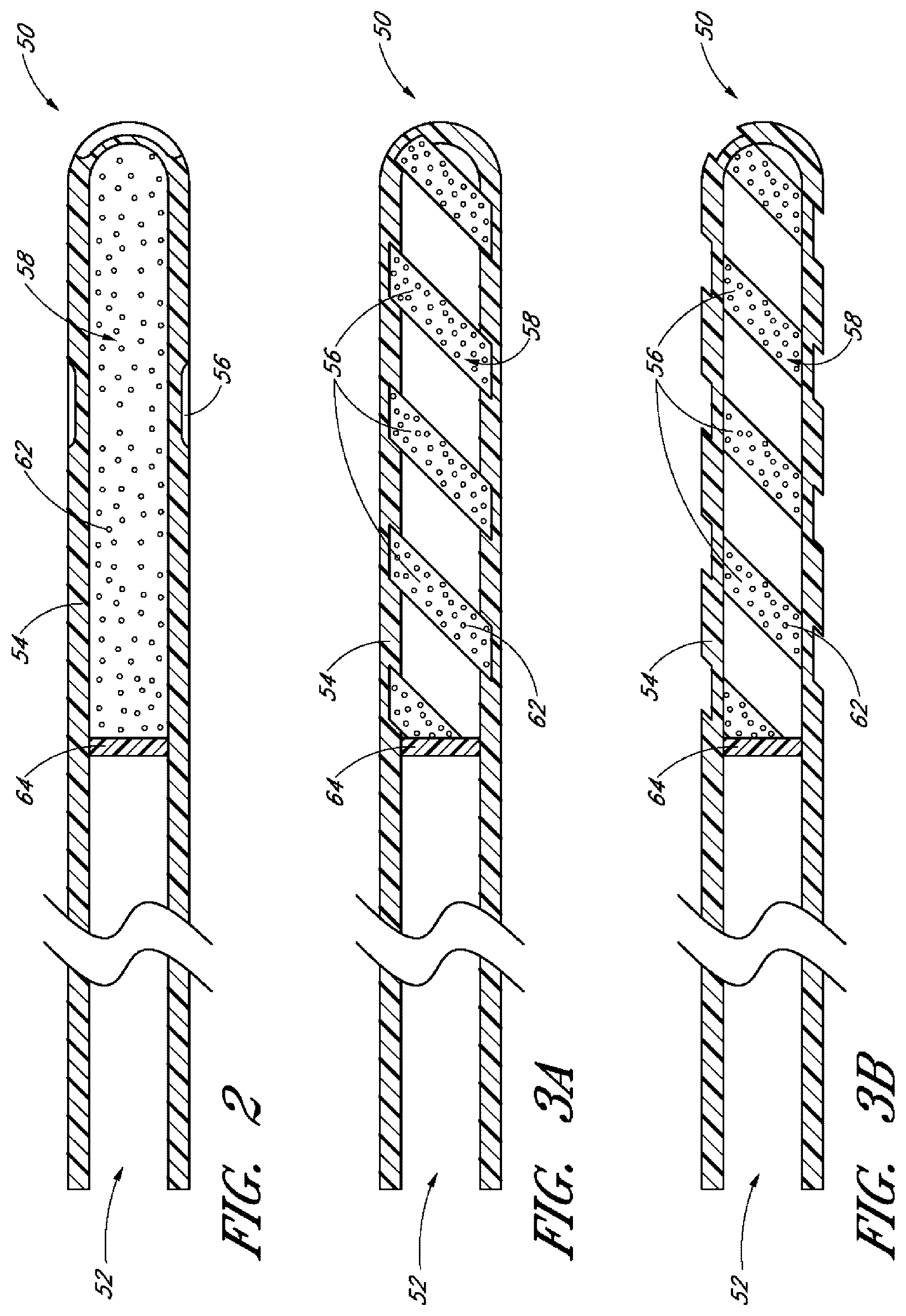 Patent US12599497 Figure 2 – Implants with controlled drug delivery features and methods of using same
