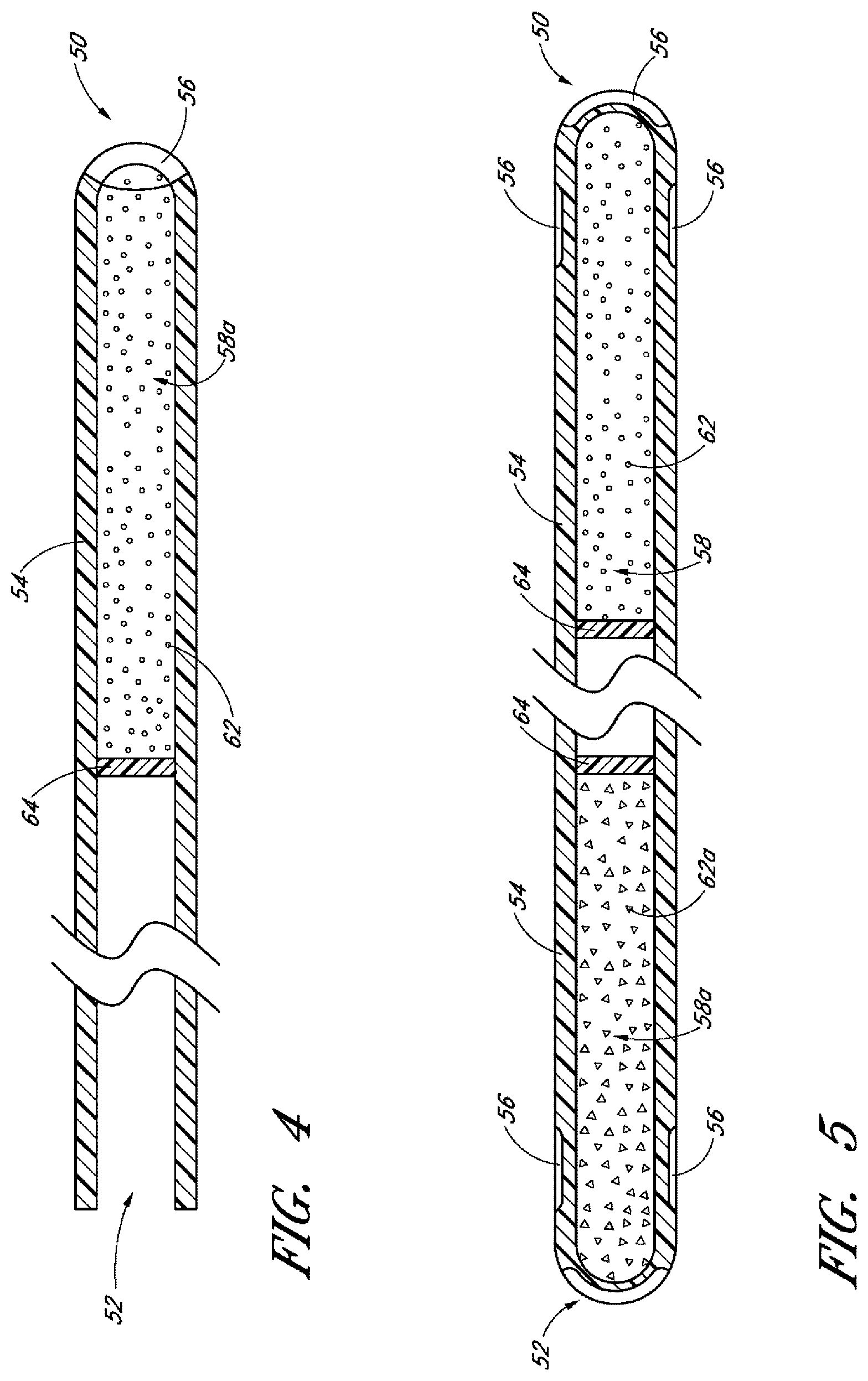 Patent US12599497 Figure 3 – Implants with controlled drug delivery features and methods of using same