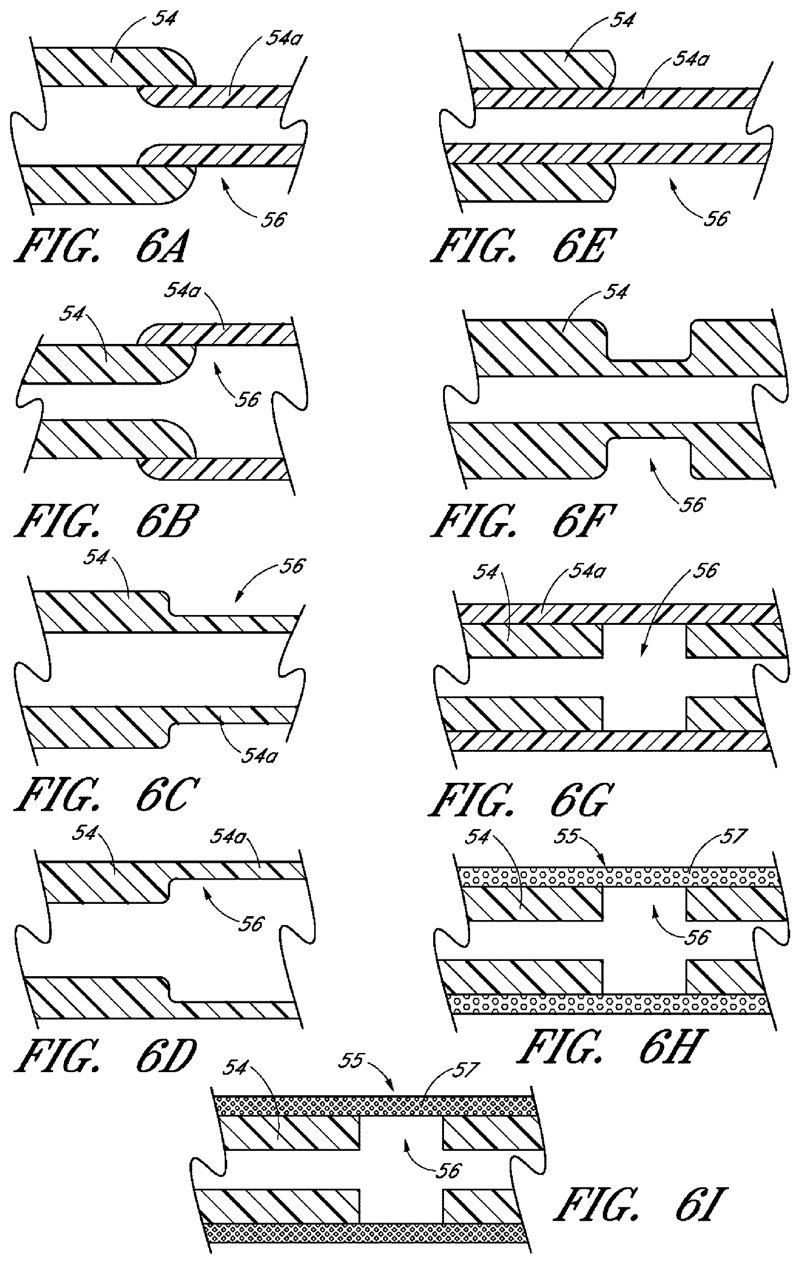 Patent US12599497 Figure 4 – Implants with controlled drug delivery features and methods of using same