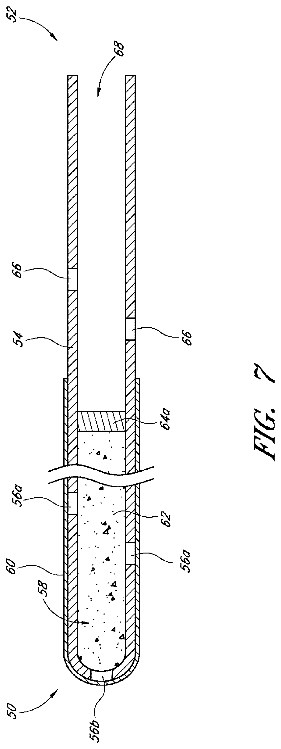 Patent US12599497 Figure 5 – Implants with controlled drug delivery features and methods of using same