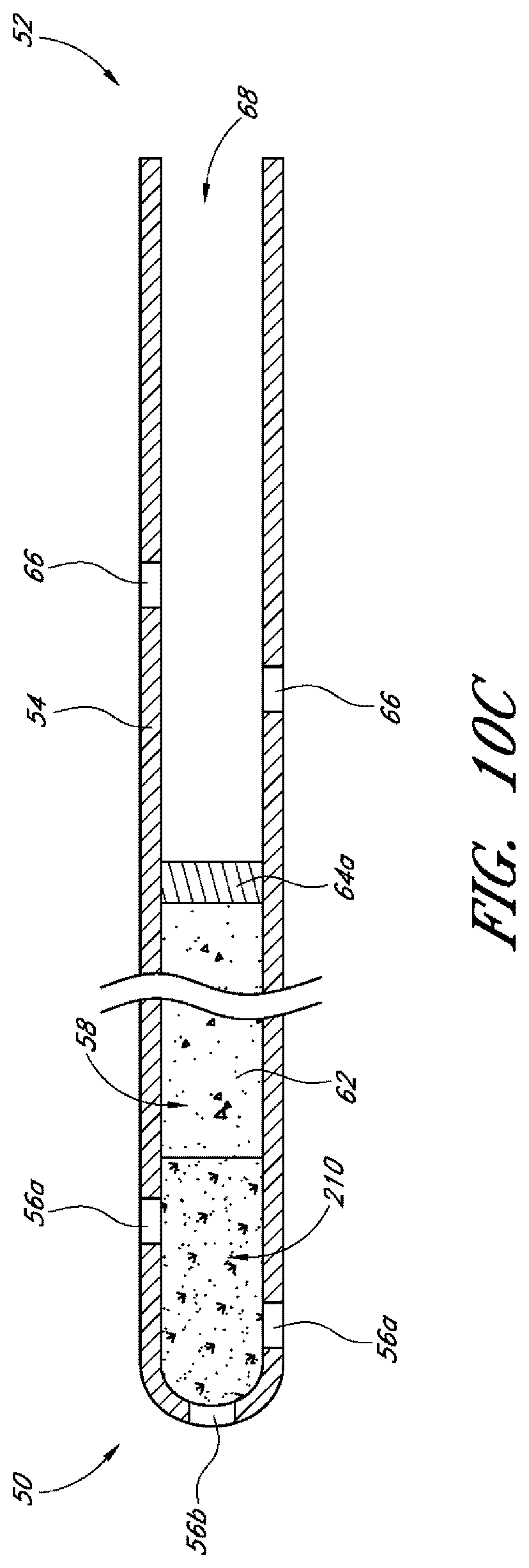 Patent US12599497 Figure 8 – Implants with controlled drug delivery features and methods of using same