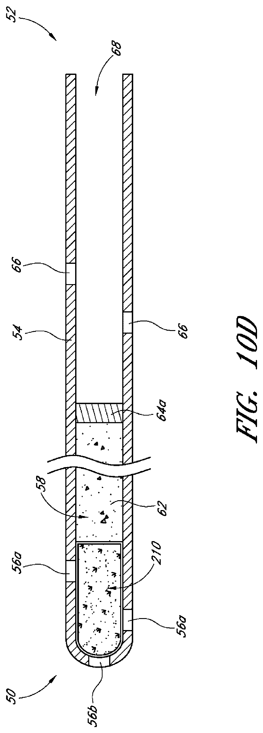 Patent US12599497 Figure 9 – Implants with controlled drug delivery features and methods of using same