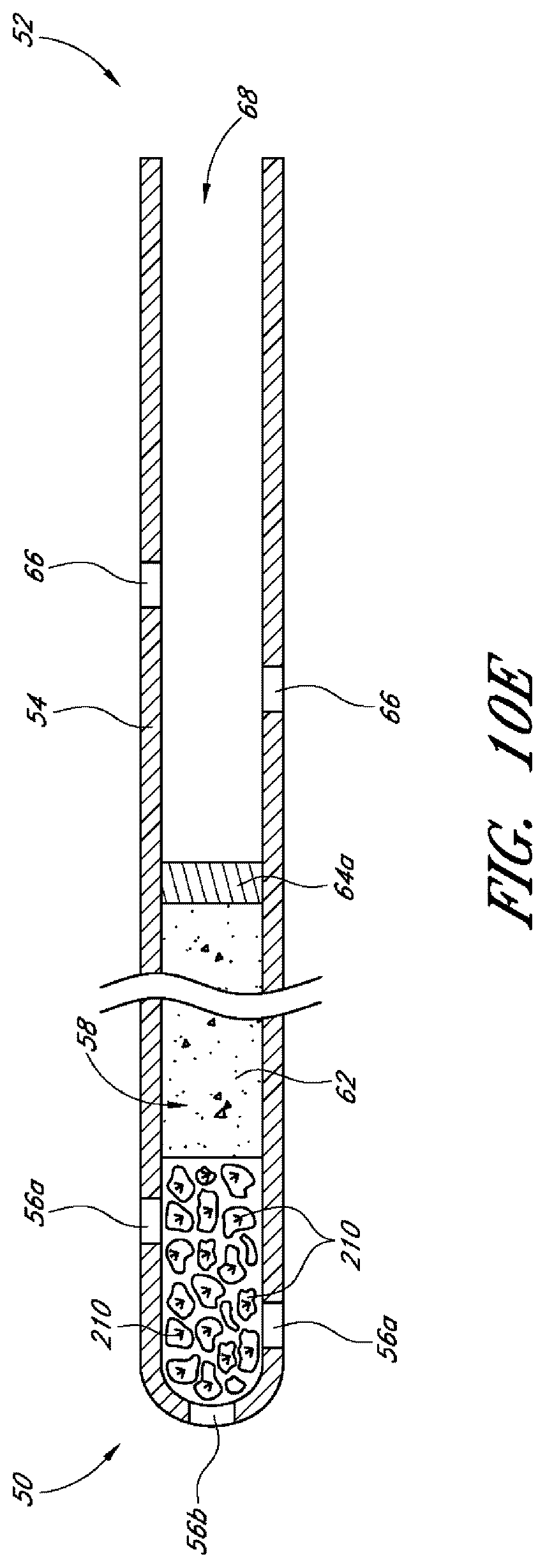 Patent US12599497 Figure 10 – Implants with controlled drug delivery features and methods of using same