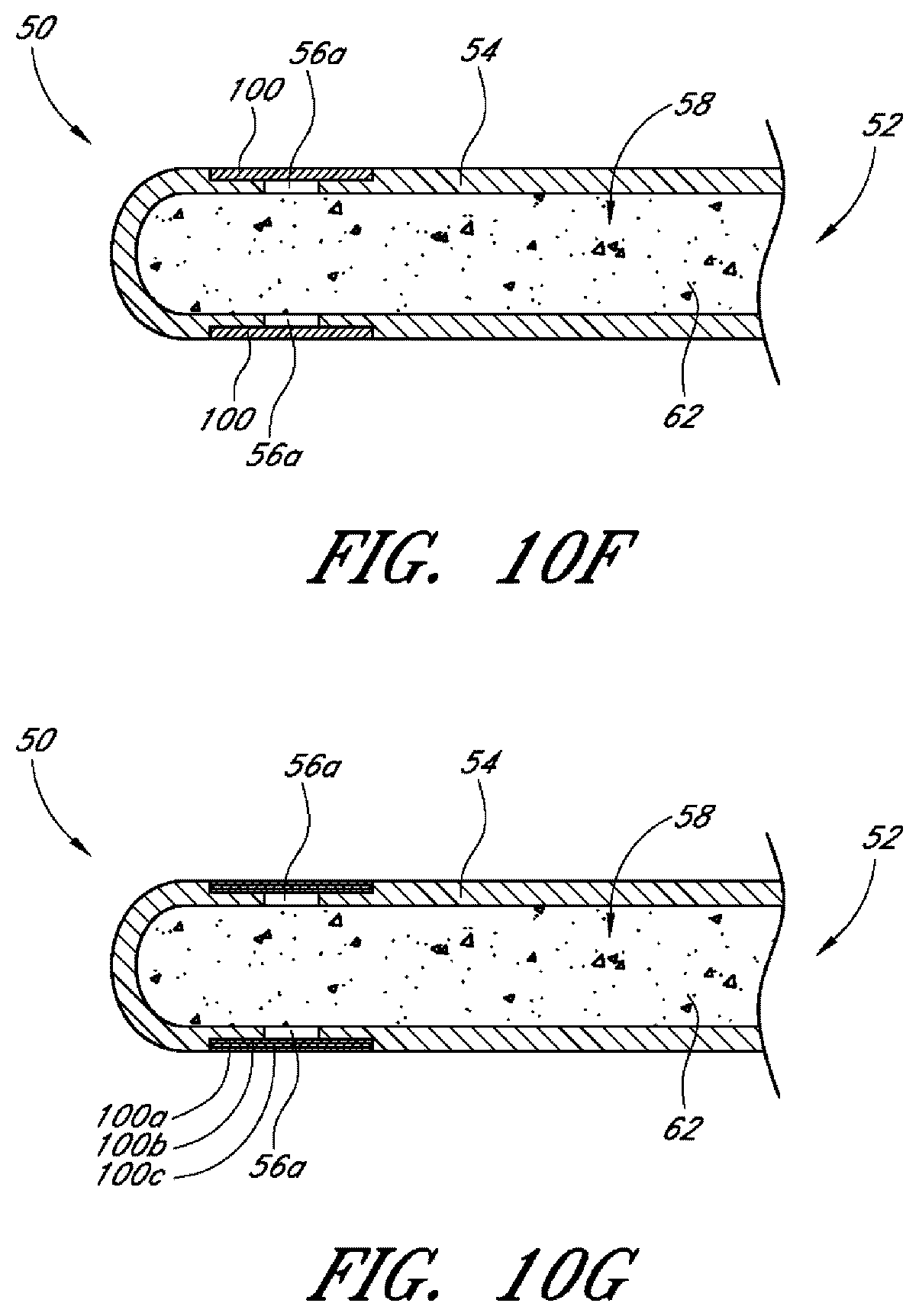 Patent US12599497 Figure 11 – Implants with controlled drug delivery features and methods of using same