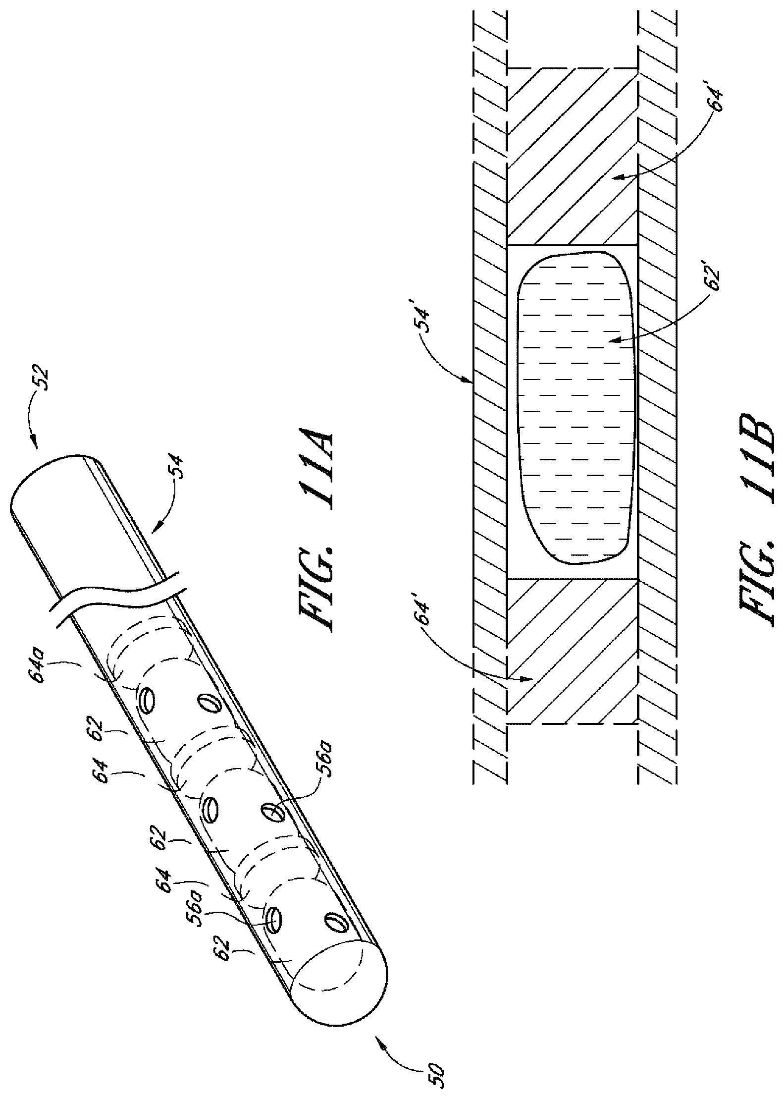 Patent US12599497 Figure 12 – Implants with controlled drug delivery features and methods of using same