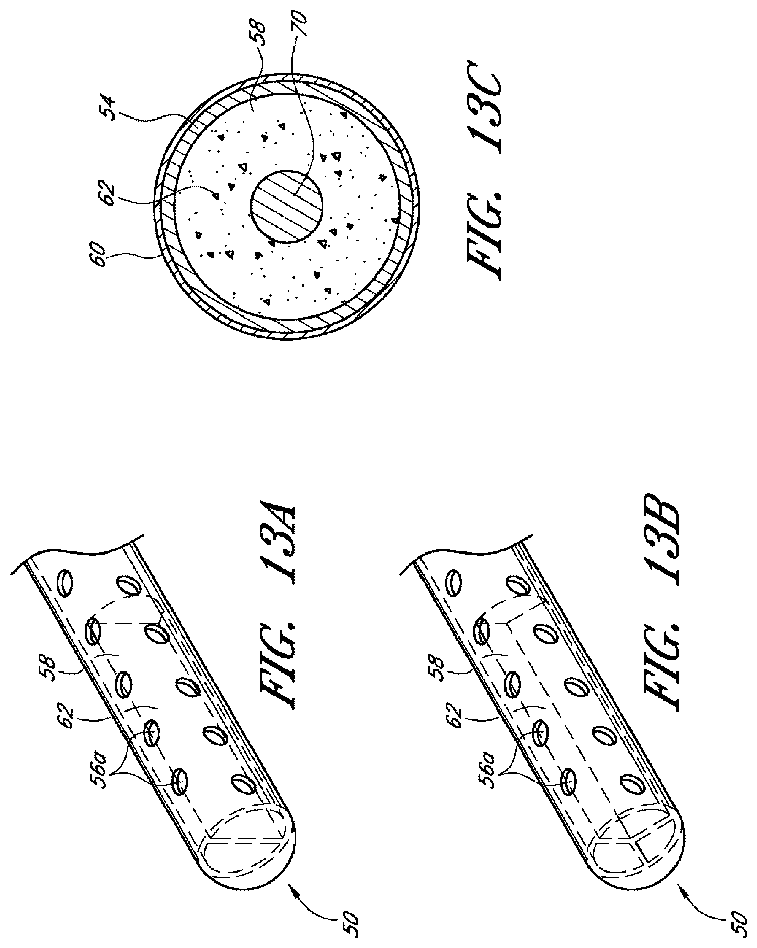 Patent US12599497 Figure 15 – Implants with controlled drug delivery features and methods of using same
