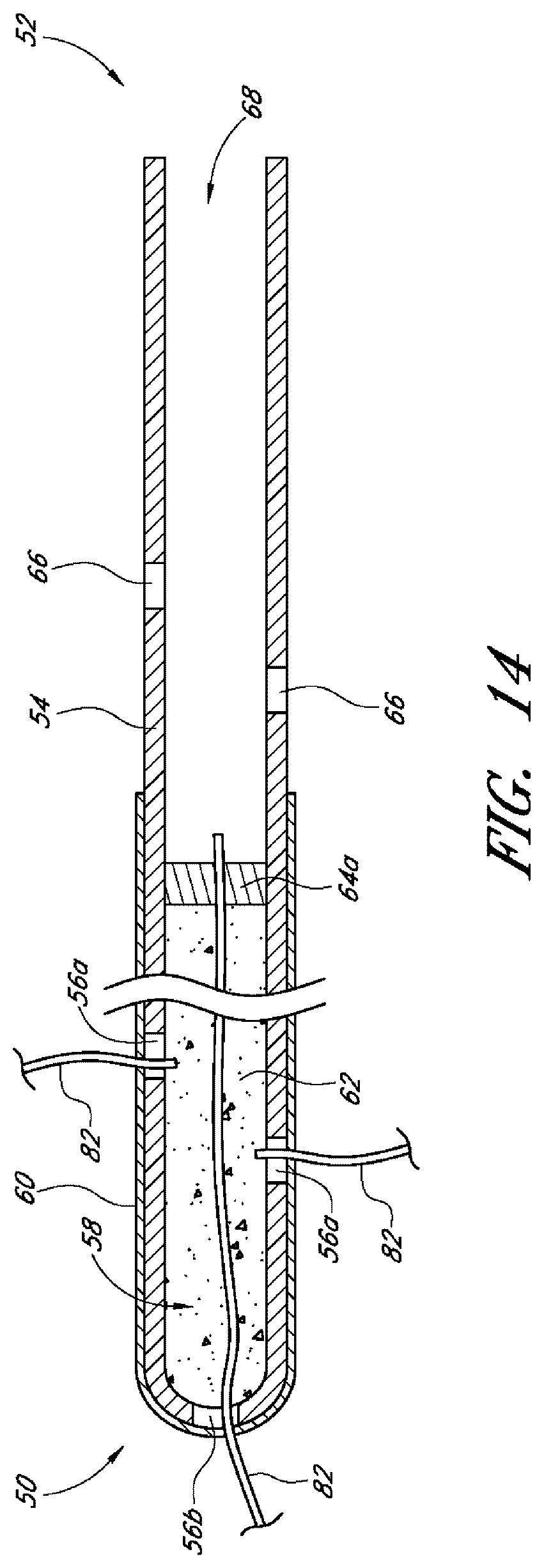 Patent US12599497 Figure 16 – Implants with controlled drug delivery features and methods of using same