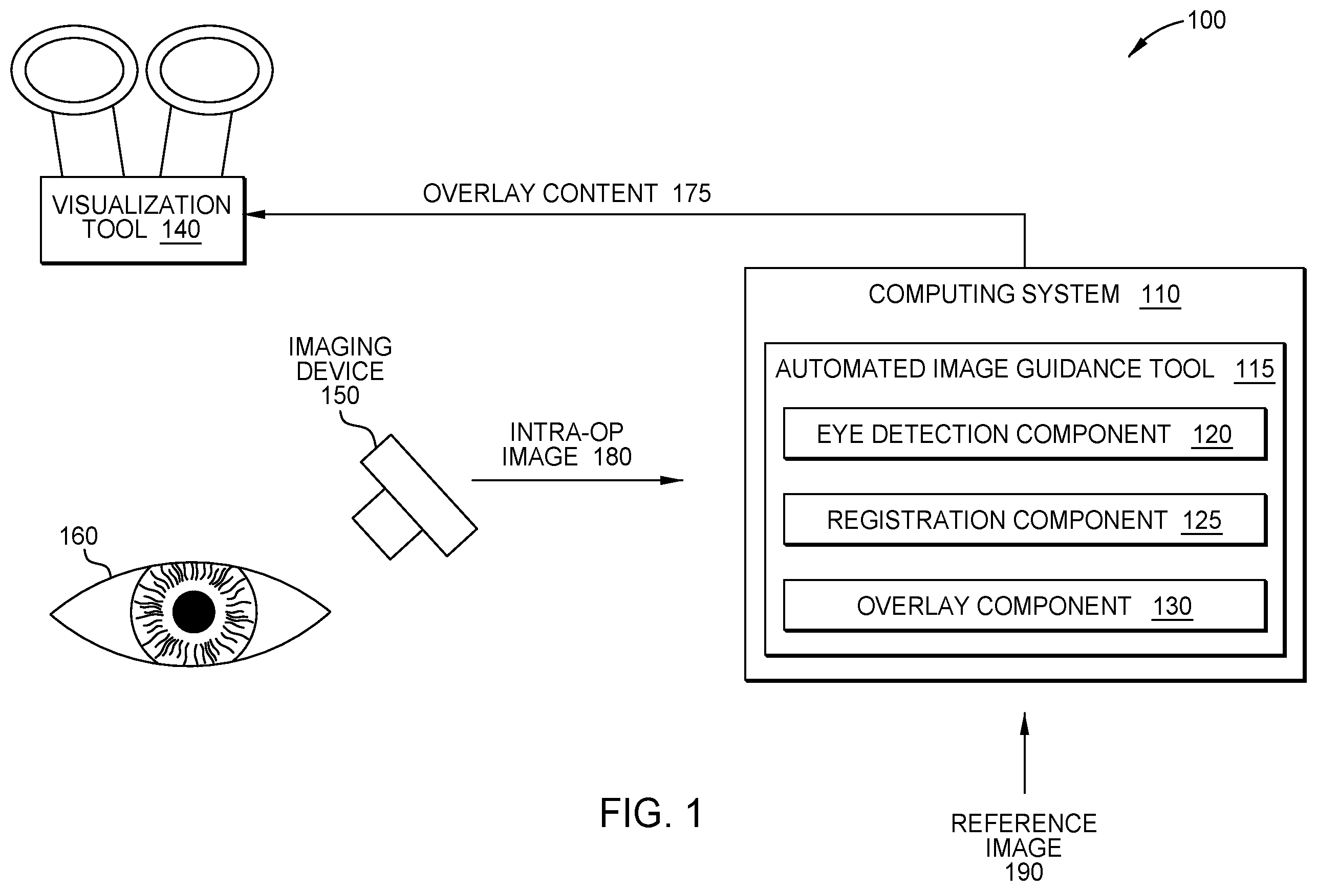 Patent US12599498 Figure 1 – Automated image guidance for ophthalmic surgery