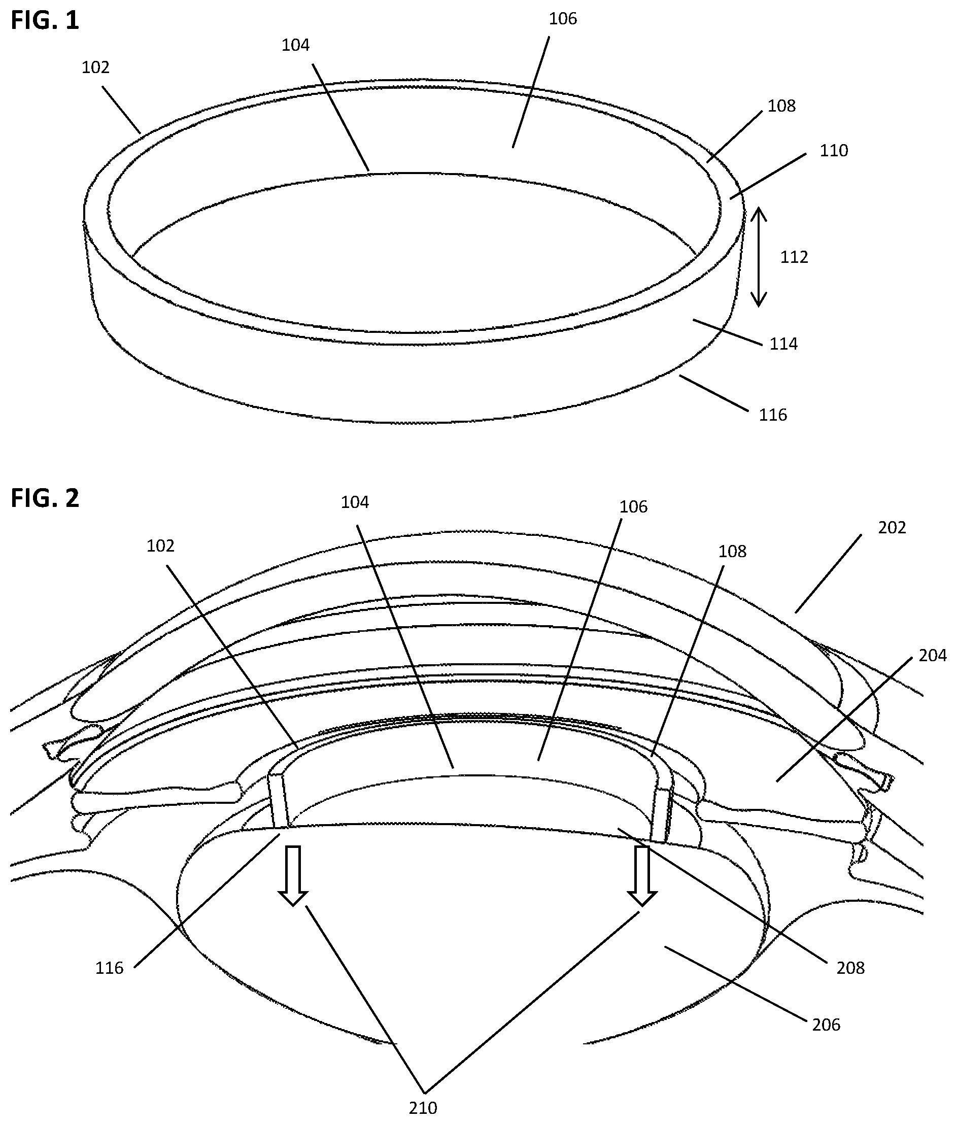 Patent US12599499 Figure 1 – Devices and methods for creating a capsulorhexis