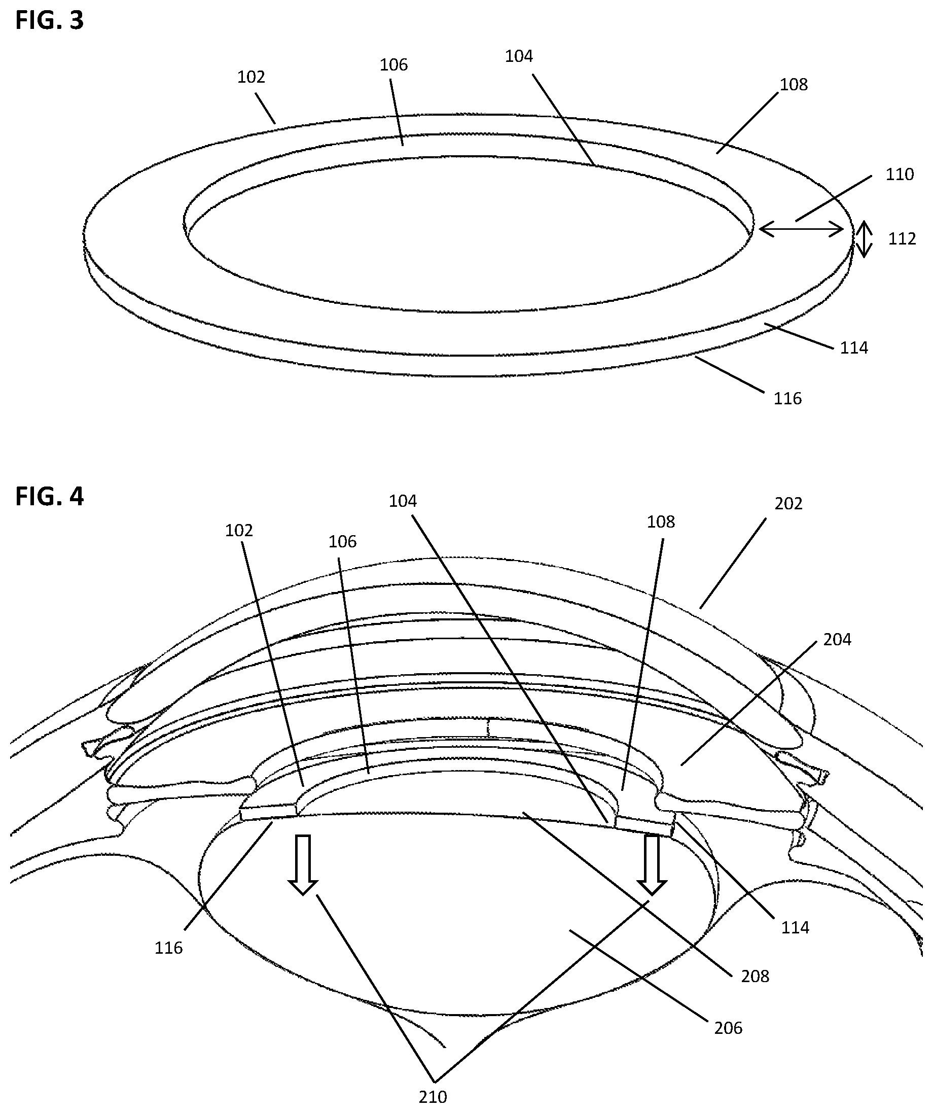 Patent US12599499 Figure 2 – Devices and methods for creating a capsulorhexis
