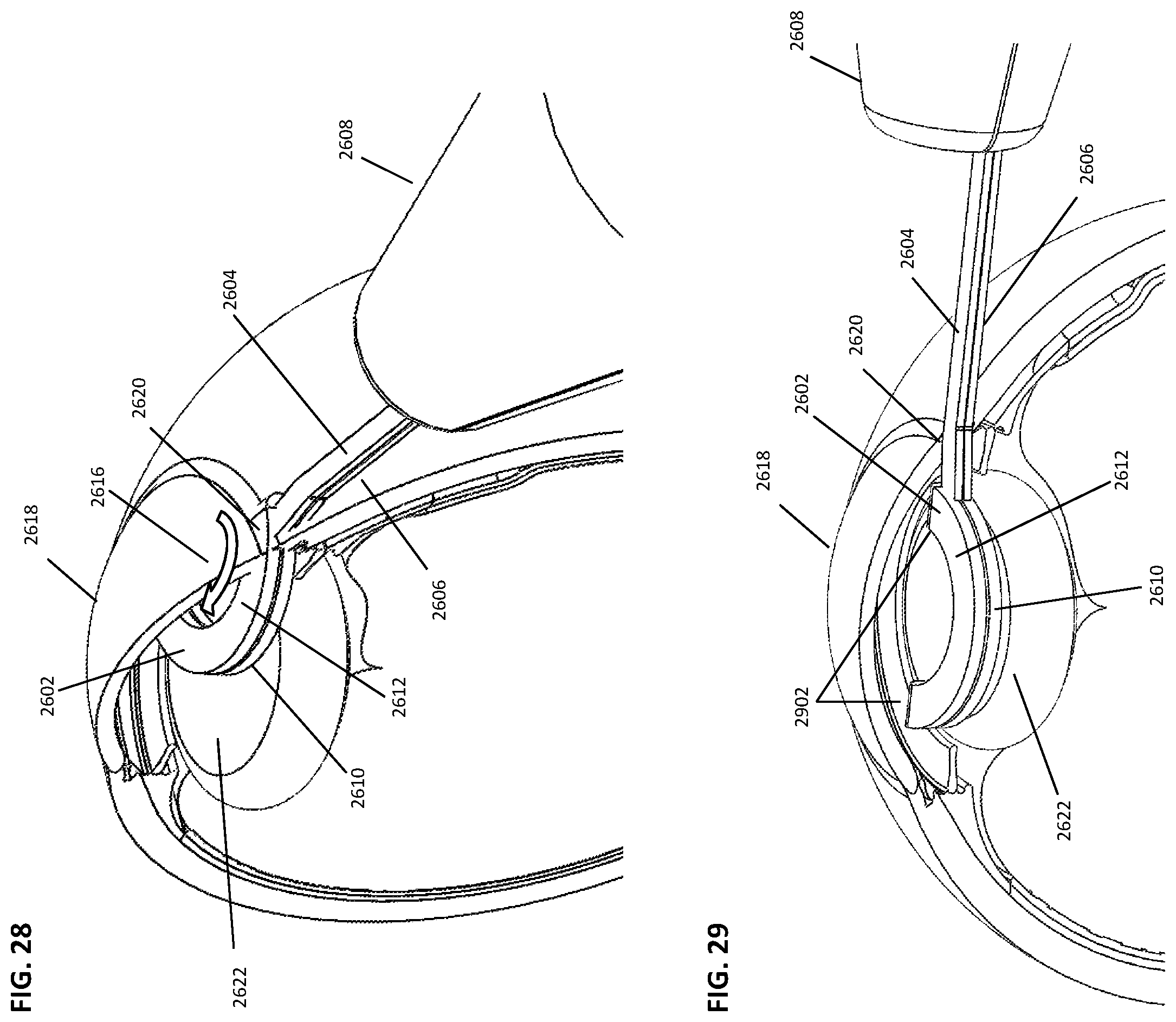 Patent US12599499 Figure 16 – Devices and methods for creating a capsulorhexis