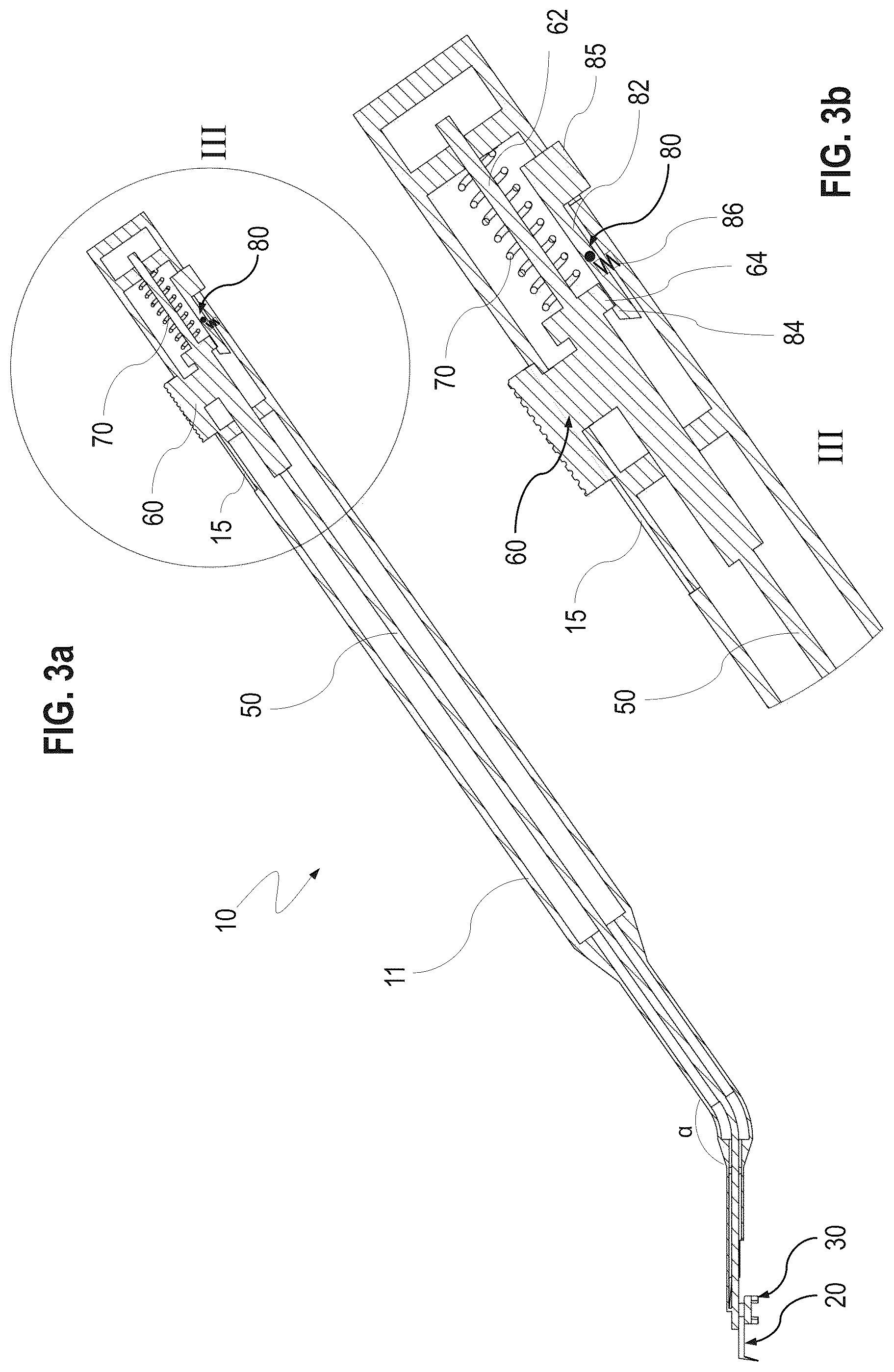 Patent US12599500 Figure 3 – Ophthalmological surgical instrument