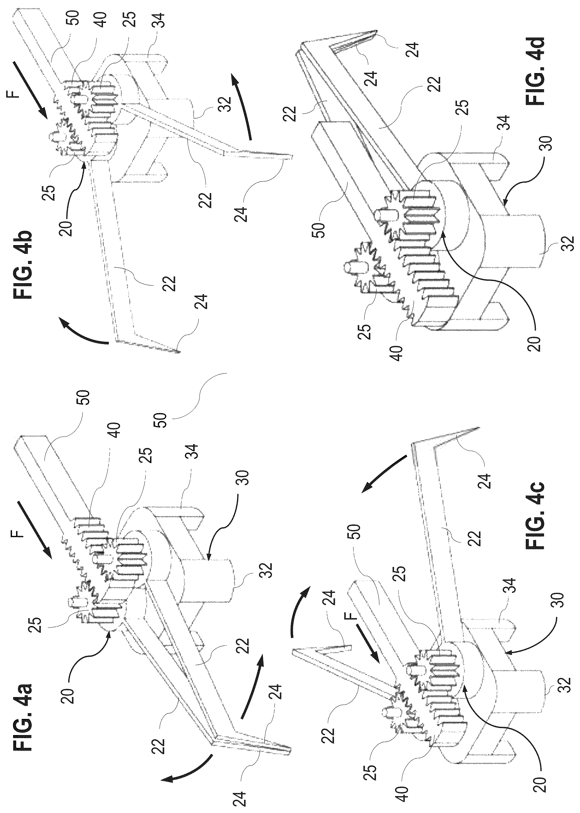 Patent US12599500 Figure 4 – Ophthalmological surgical instrument