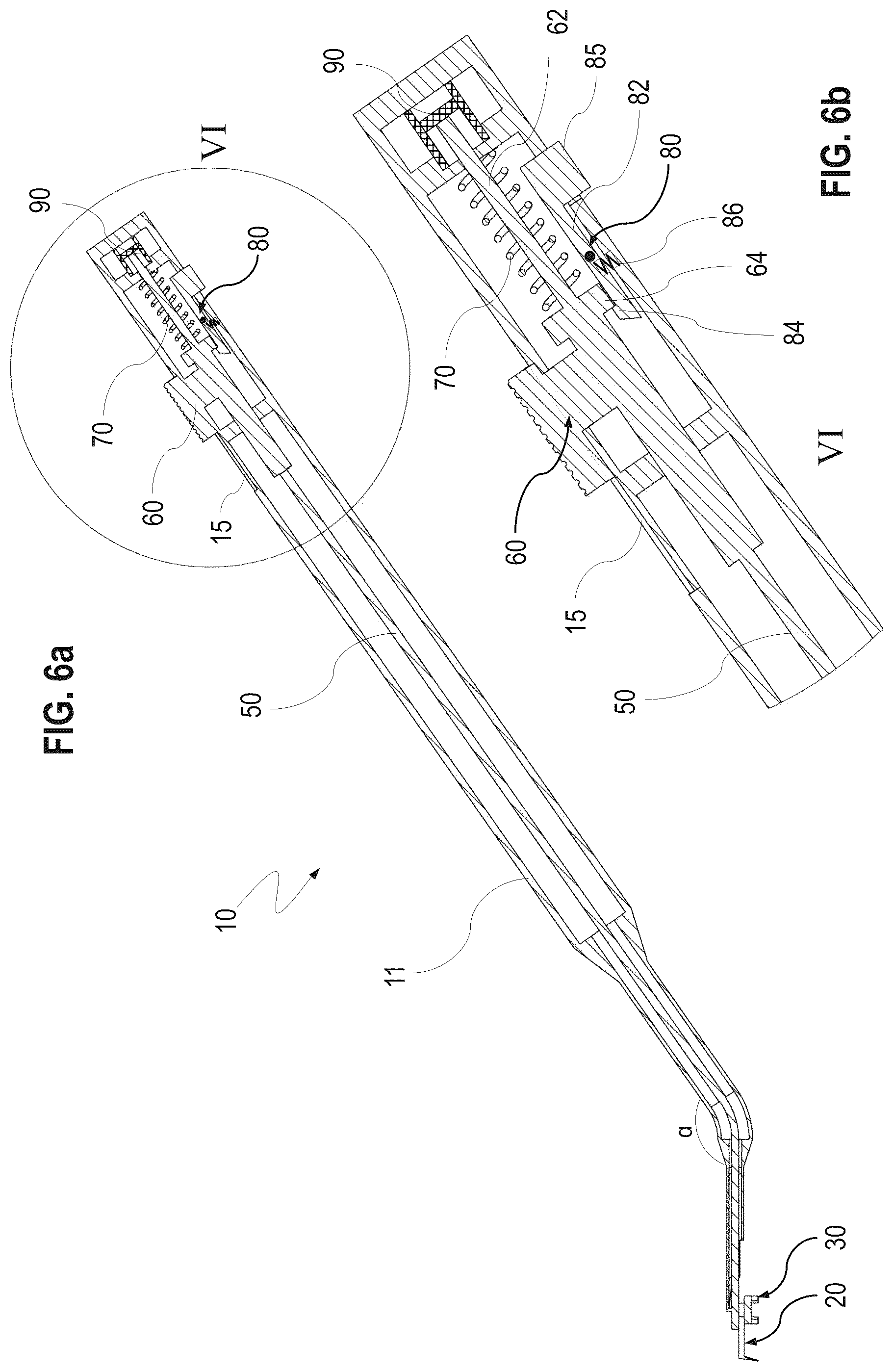 Patent US12599500 Figure 6 – Ophthalmological surgical instrument