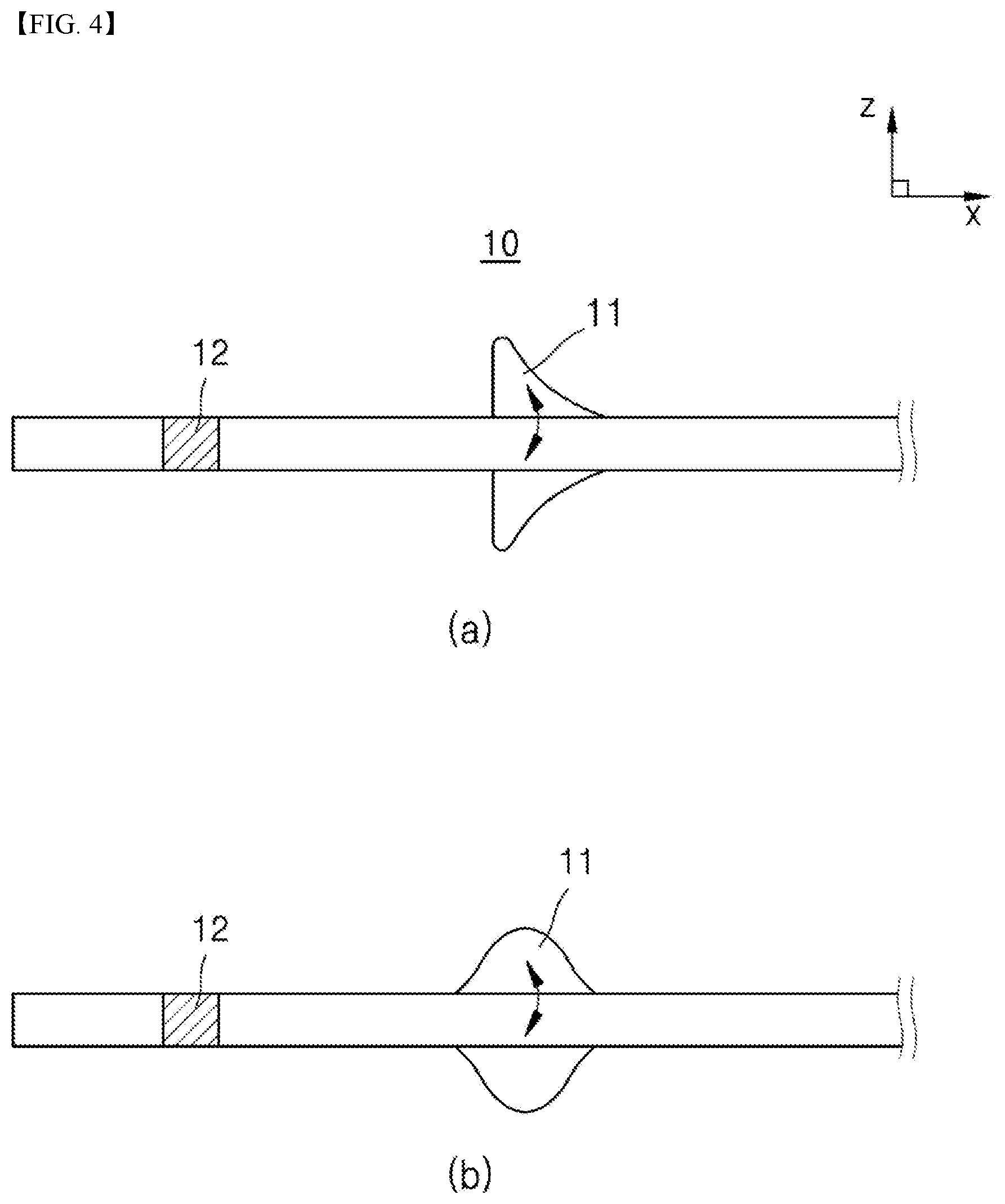 Patent US12599501 Figure 3 – Eye disease implant device capable of lowering eye pressure by easy and safe method