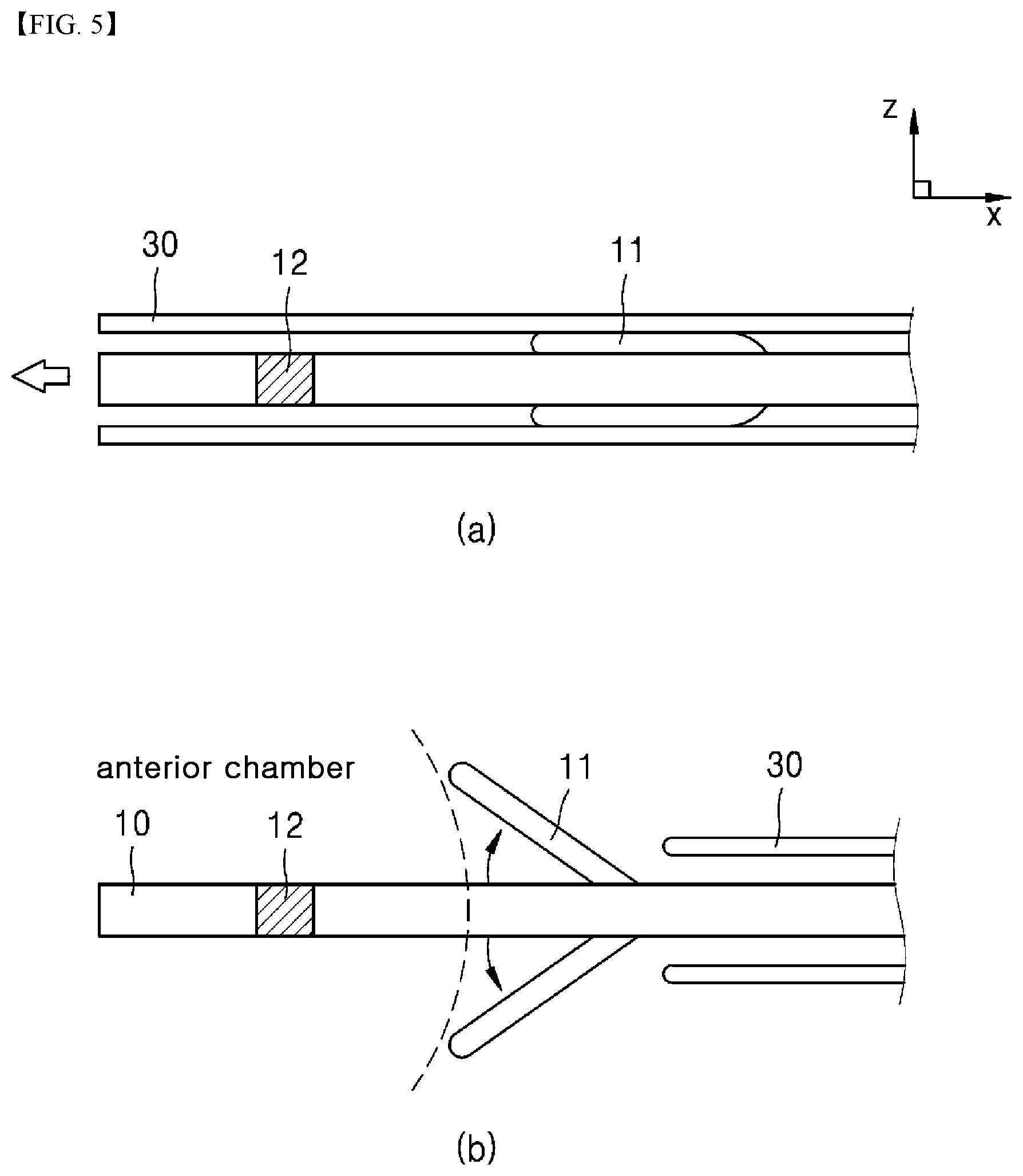 Patent US12599501 Figure 4 – Eye disease implant device capable of lowering eye pressure by easy and safe method