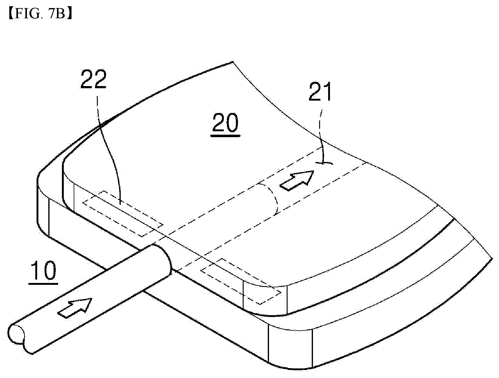 Patent US12599501 Figure 7 – Eye disease implant device capable of lowering eye pressure by easy and safe method