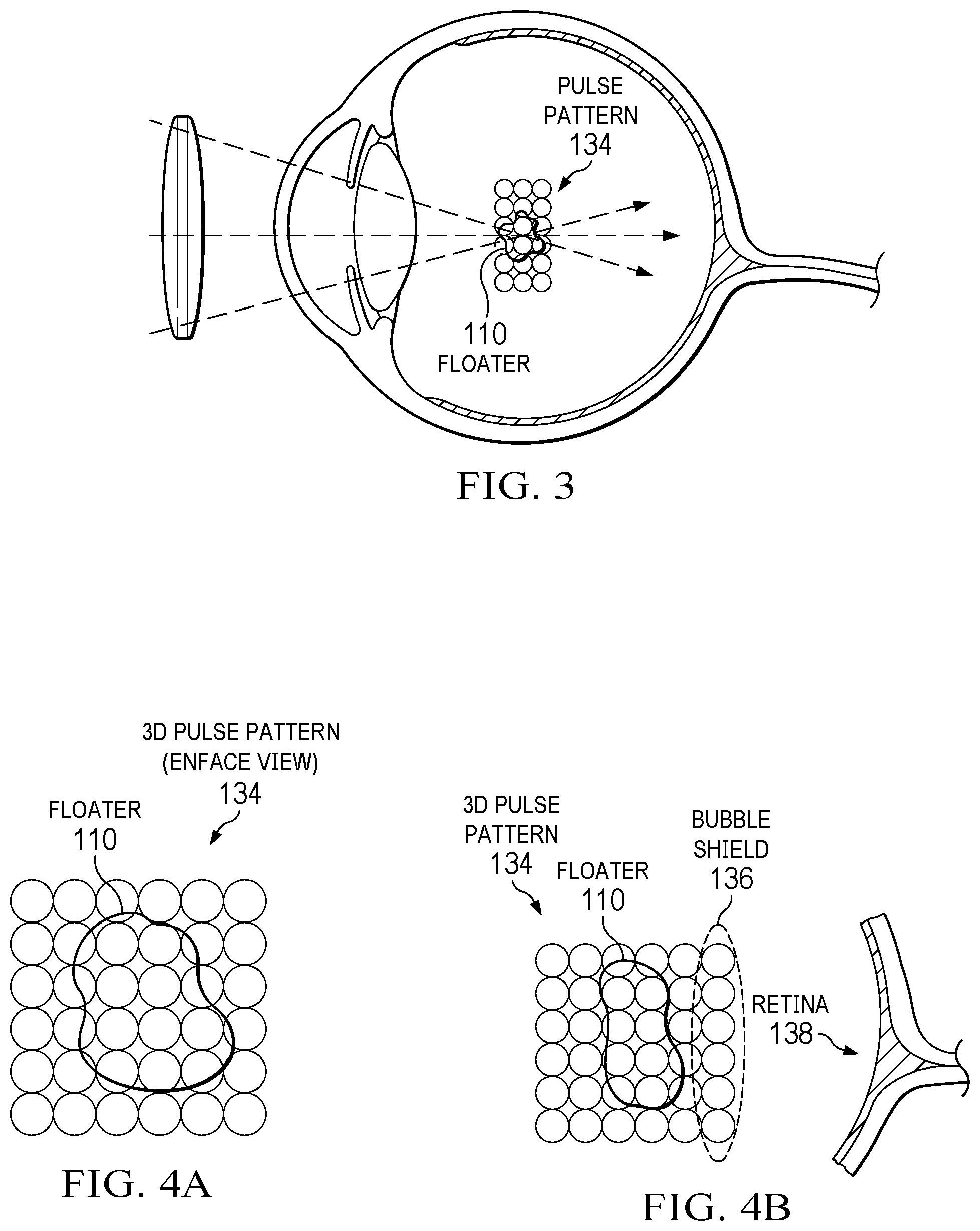 Patent US12599502 Figure 3 – Reducing retinal radiation exposure during laser surgery