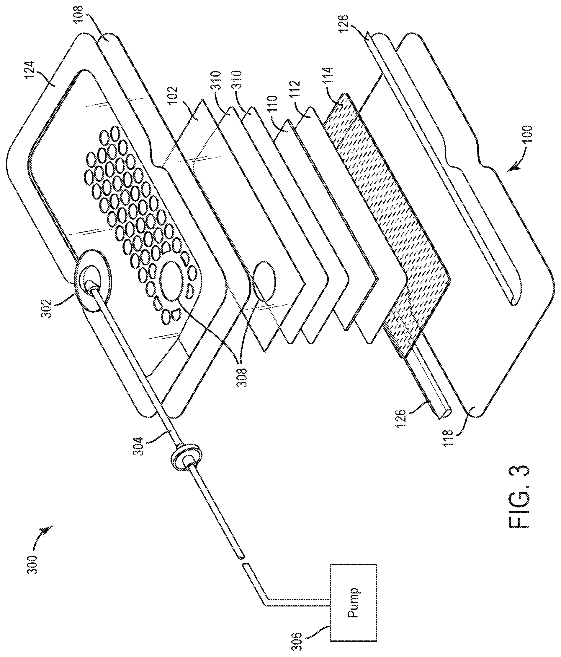 Patent US12599504 Figure 3 – Wound dressing with fluid management