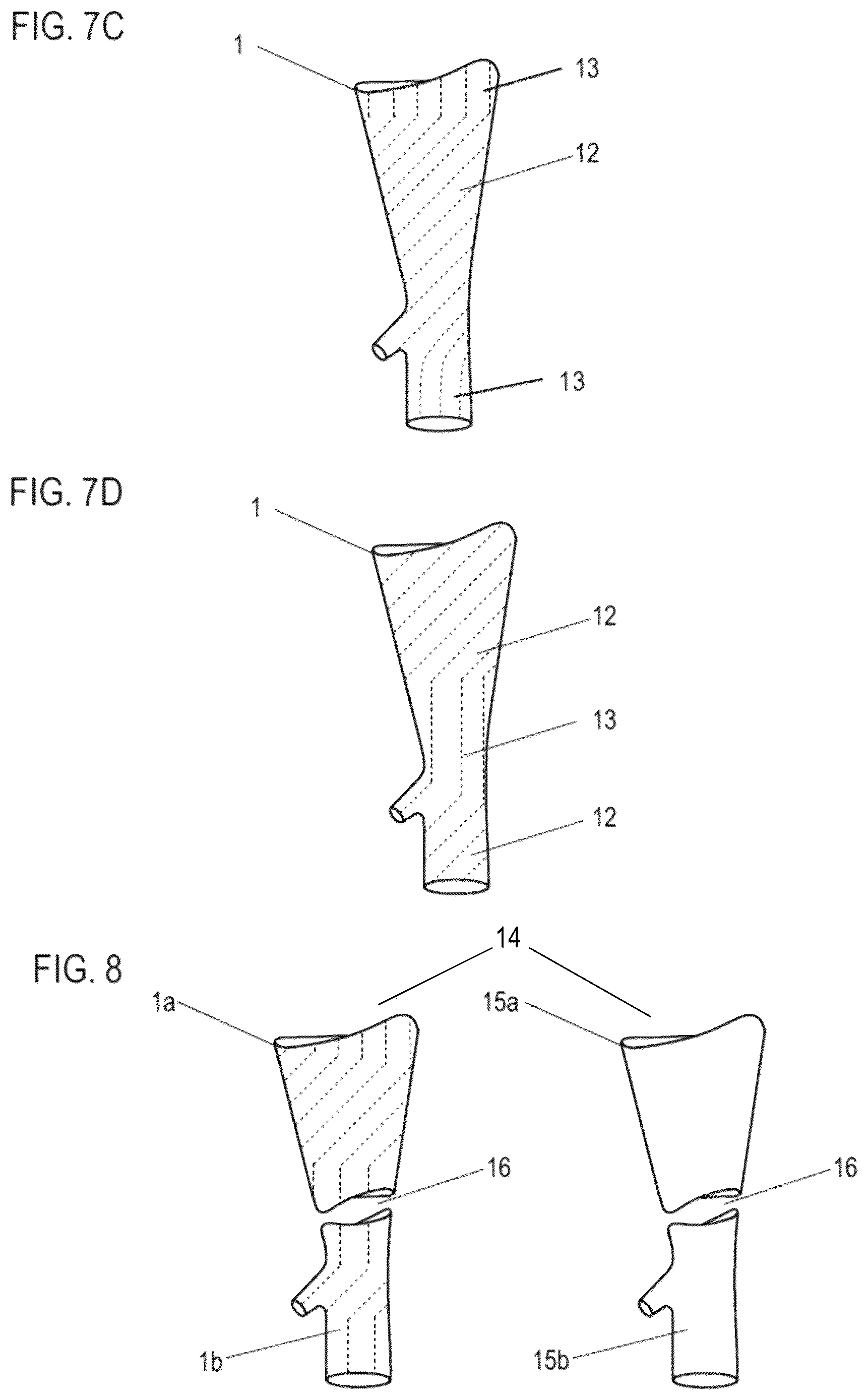 Patent US12599505 Figure 5 – Compression garment and method for manufacturing a compression garment