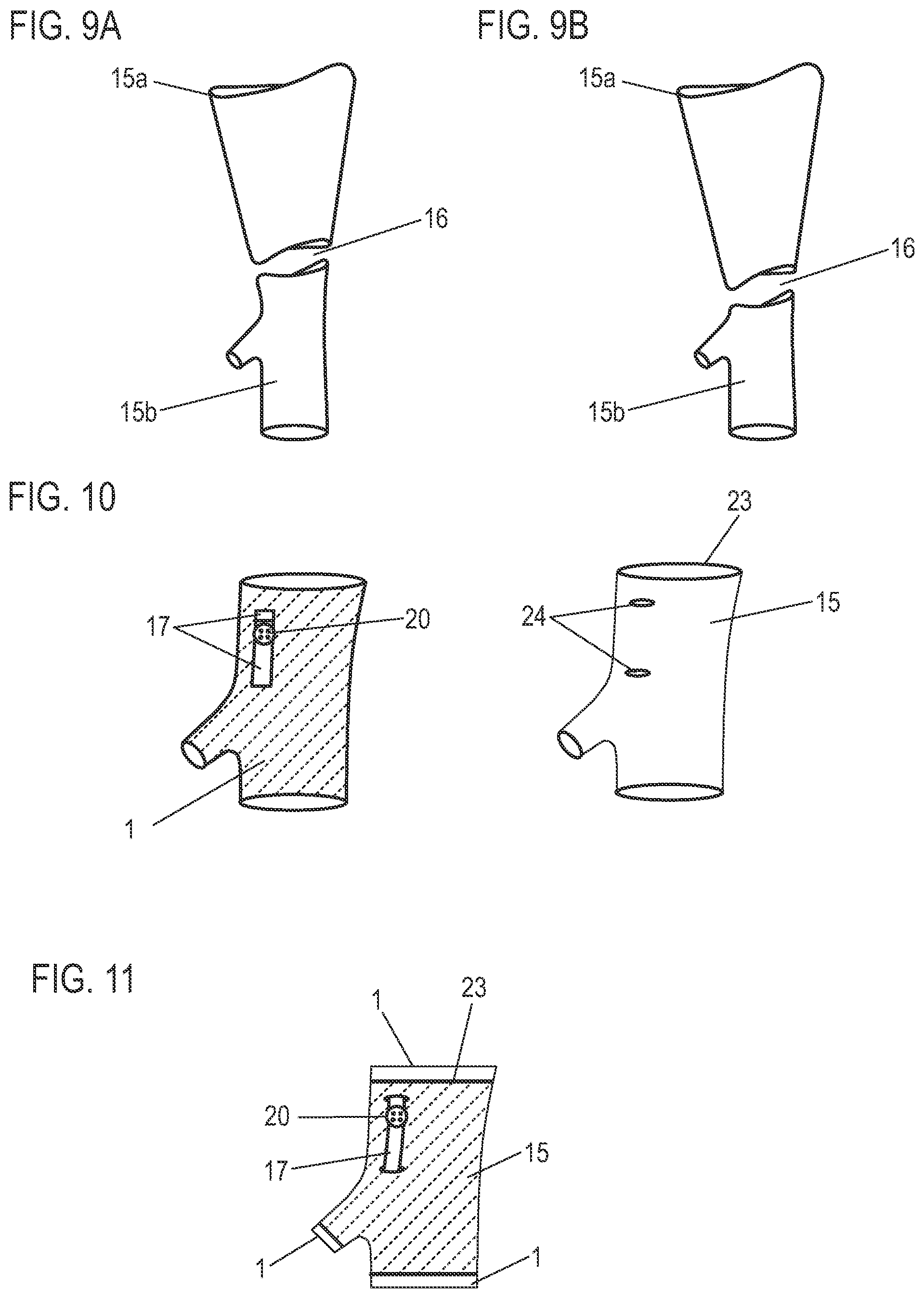 Patent US12599505 Figure 6 – Compression garment and method for manufacturing a compression garment