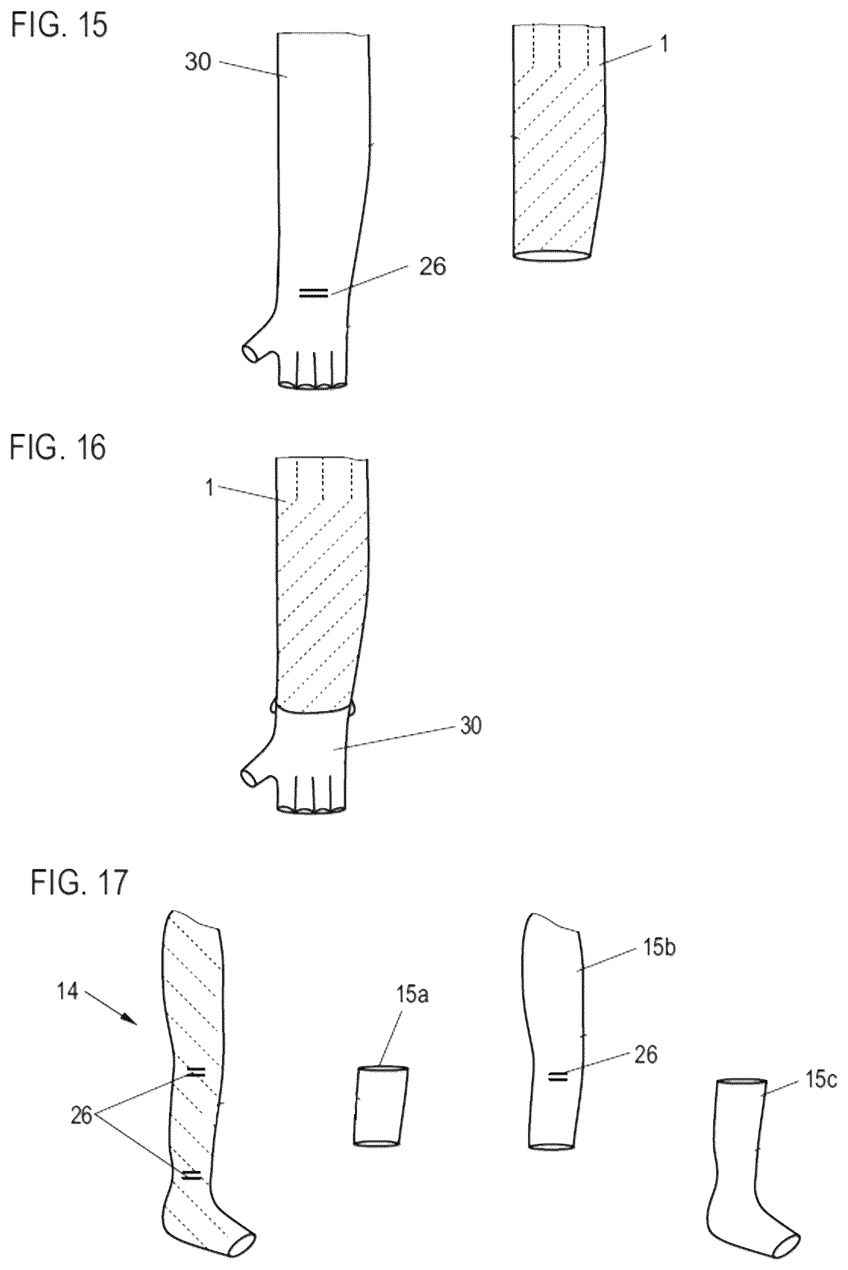 Patent US12599505 Figure 8 – Compression garment and method for manufacturing a compression garment