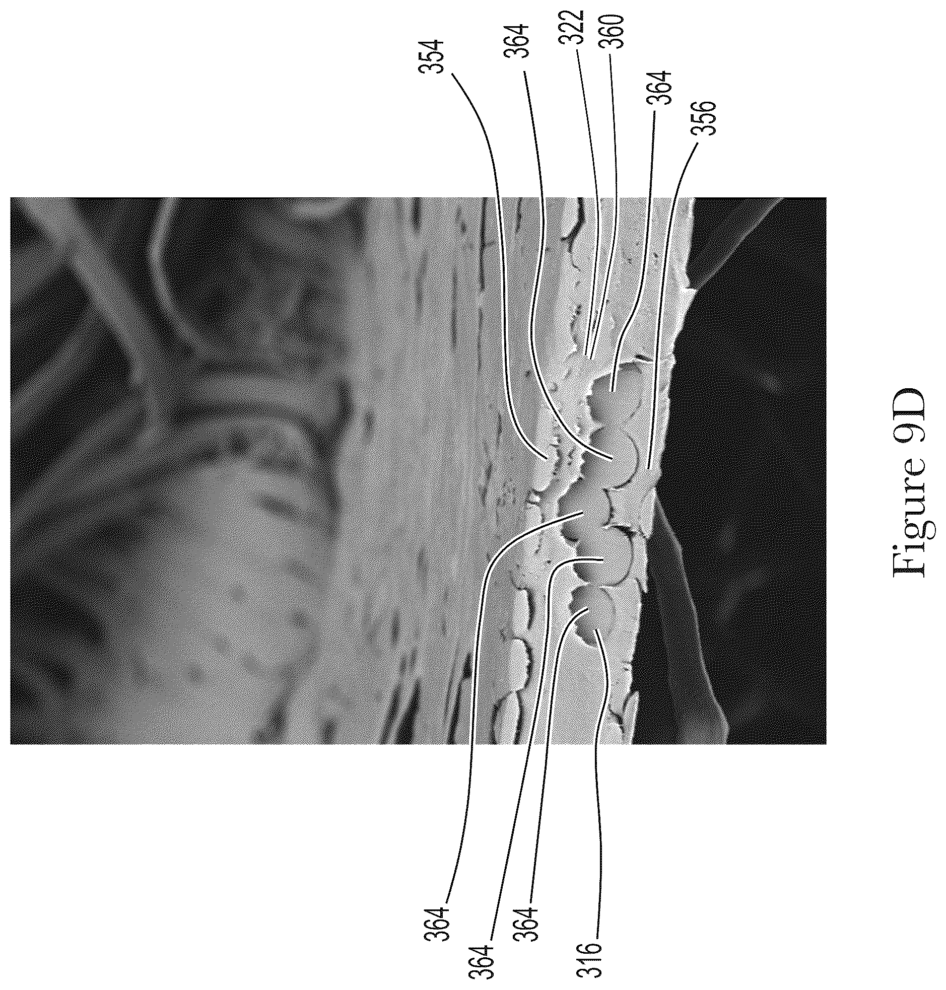 Patent US12599506 Figure 15 – Method for making elastomeric laminates