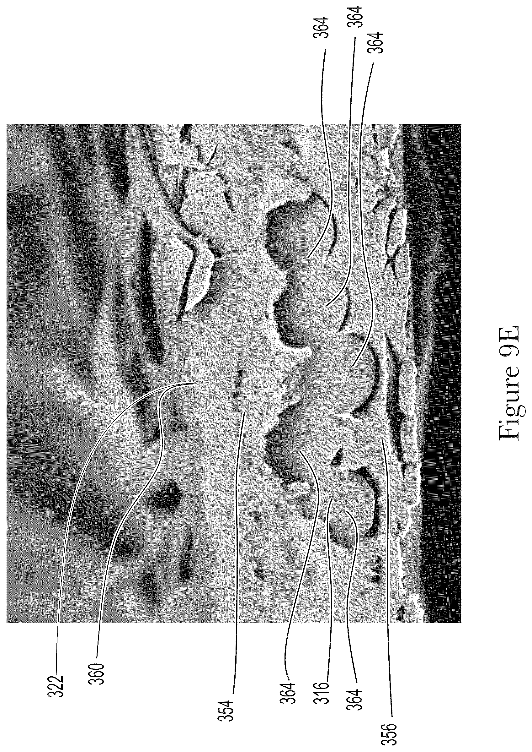 Patent US12599506 Figure 16 – Method for making elastomeric laminates