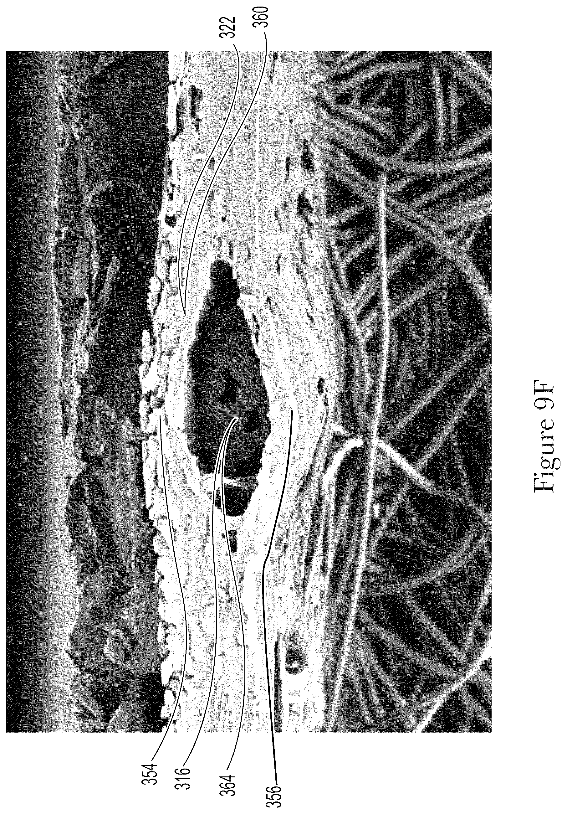 Patent US12599506 Figure 17 – Method for making elastomeric laminates