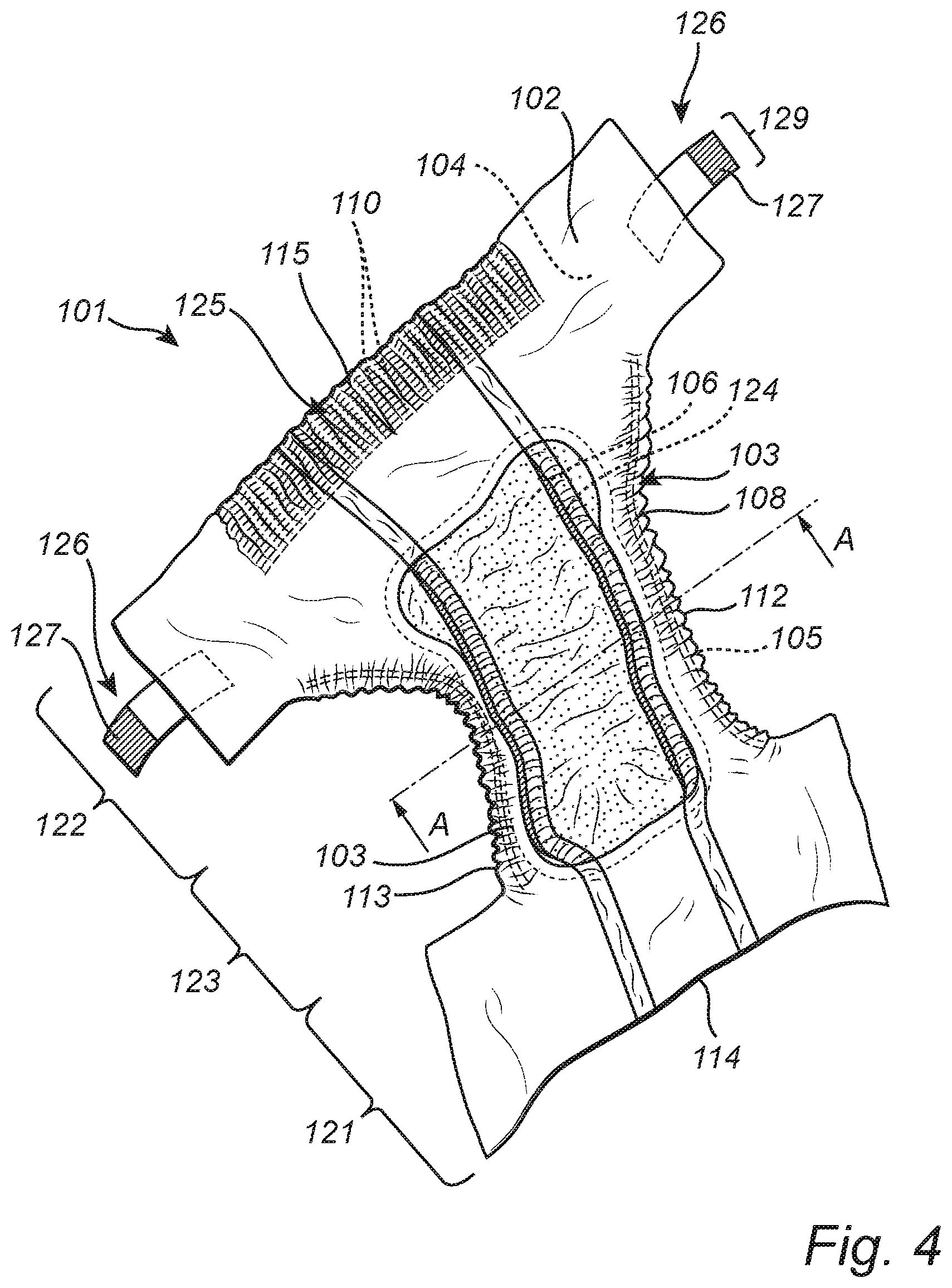 Patent US12599507 Figure 4 – Method and apparatus for manufacturing an elastic laminate and a disposable absorbent hygiene product comprising the elastic laminate