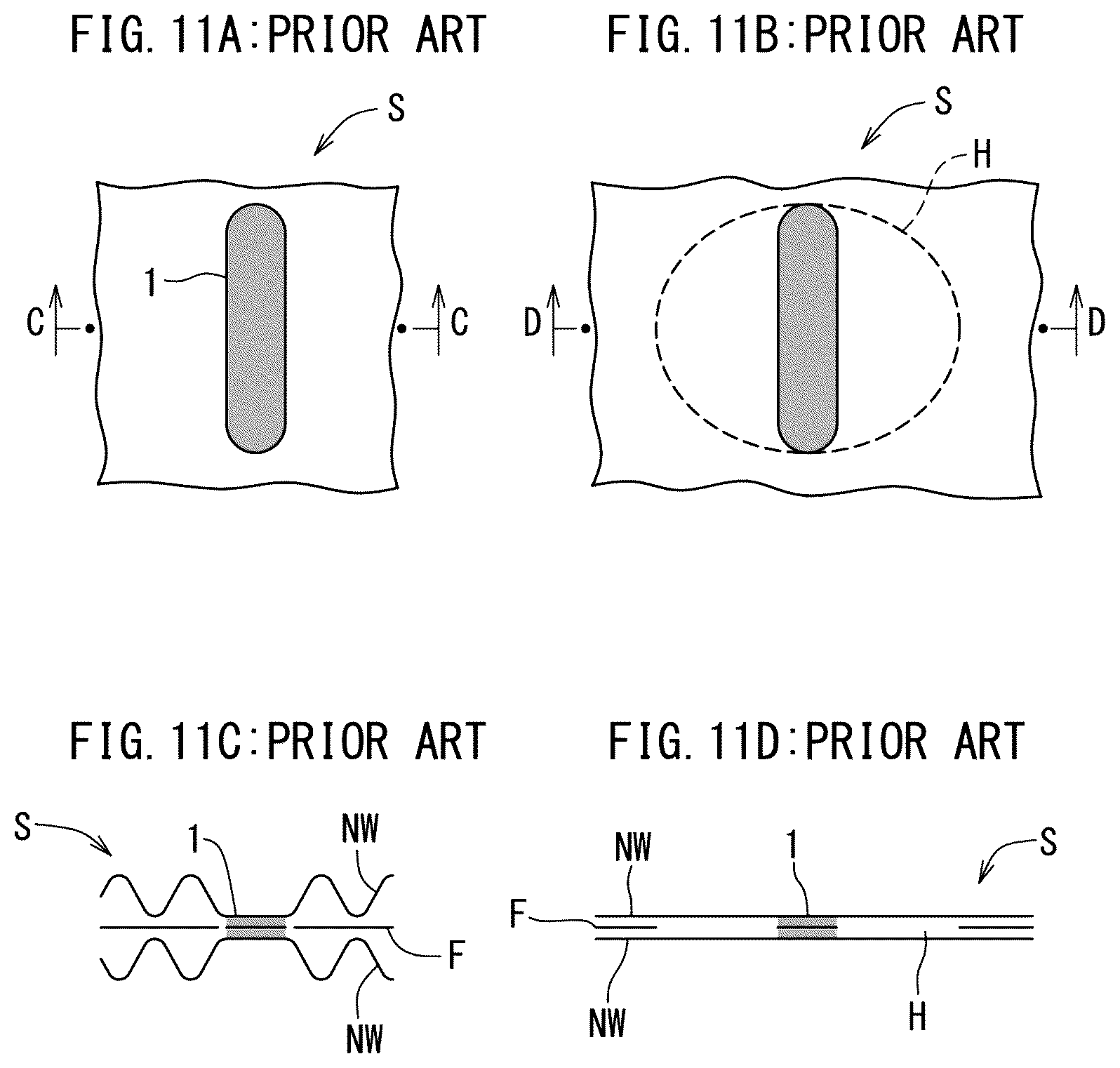 Patent US12599513 Figure 11 – Stretch layered sheet, disposable wearing article, and method and device for manufacturing stretch layered sheet